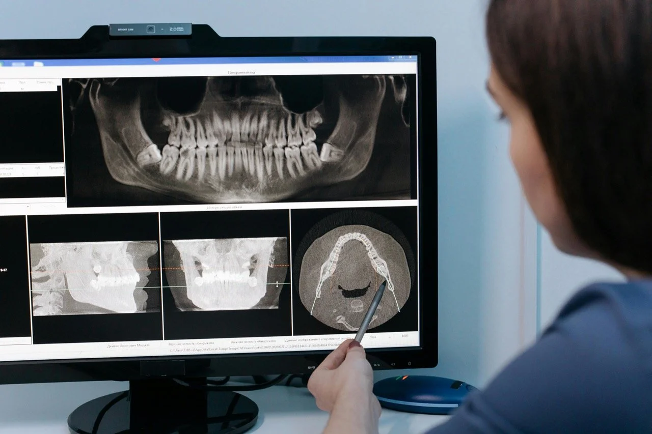 A dental professional analyzing dental X-rays and scans on a computer monitor, showing images of teeth and jaw structures.