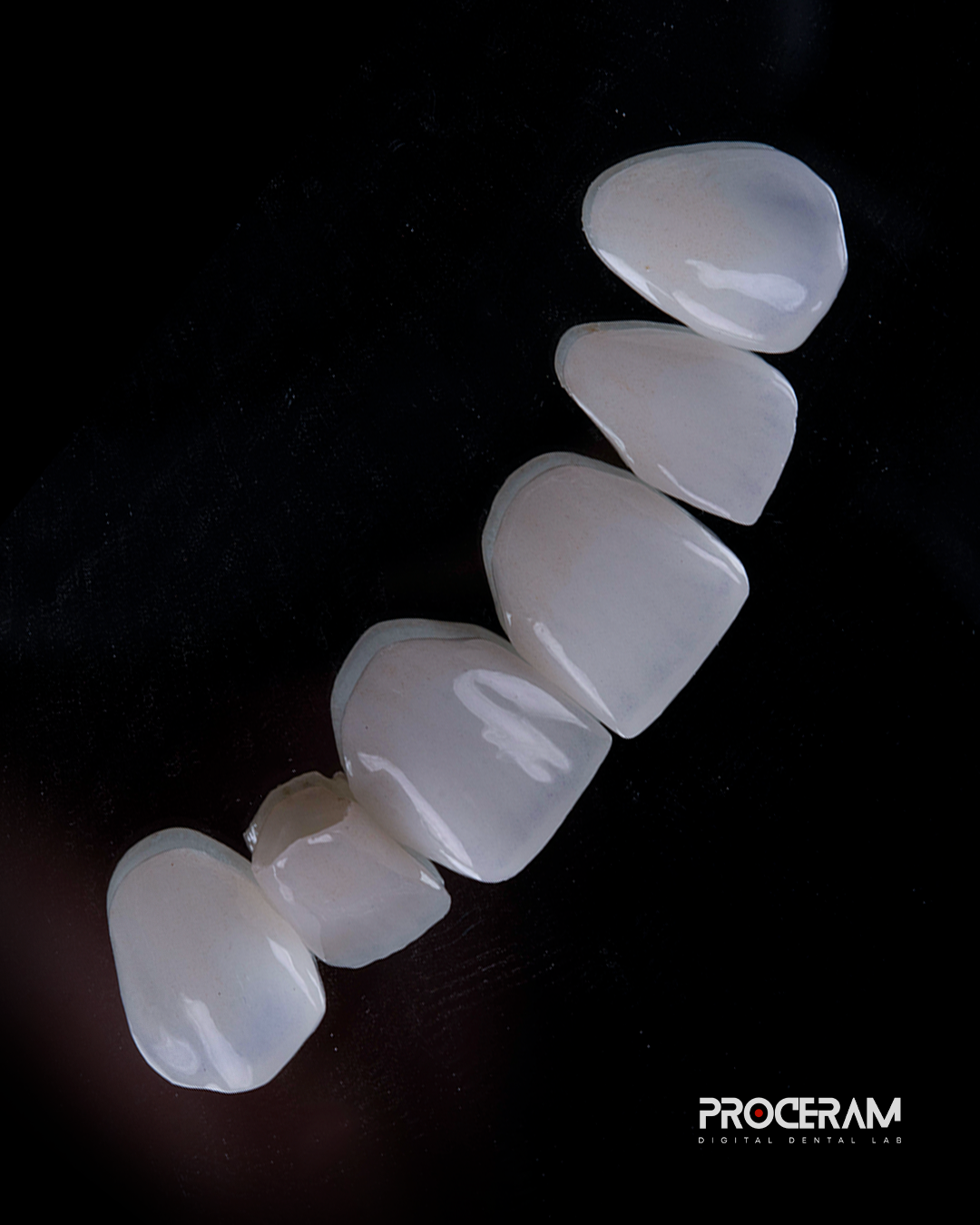Lentes de contato Dental.png