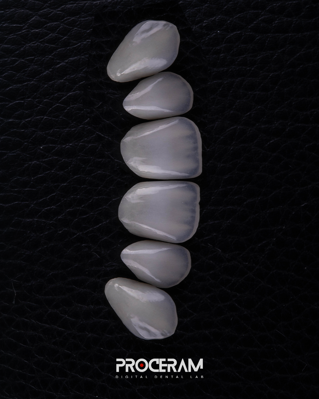 extratificied Veneer.png