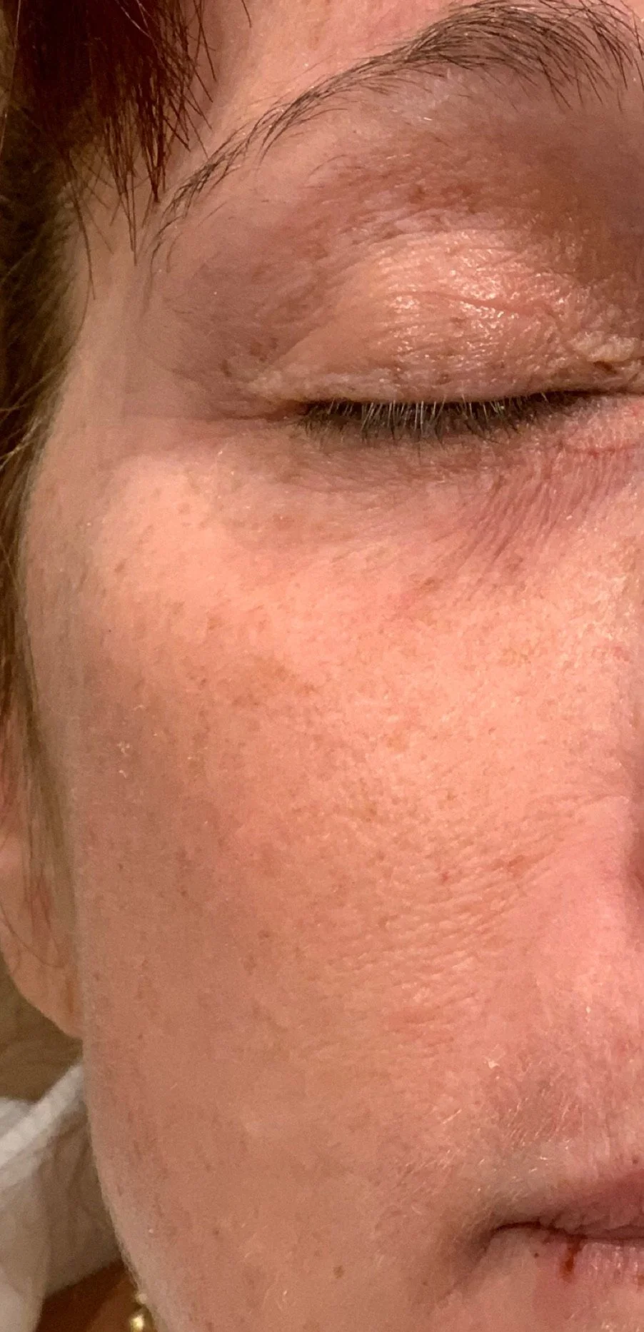 Close-up of a person's face with closed eye, visible eyebrow and skin texture.
