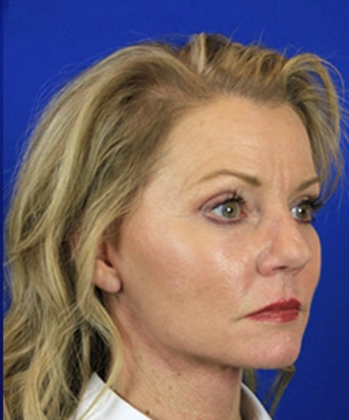 Close-up of a woman with blonde hair, green eyes, and red lipstick, looking to the right against a blue background.