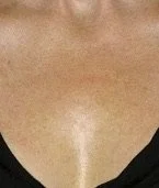 Close-up of a person's upper chest and lower neck, with a visible shadow or reflection beneath the chin.