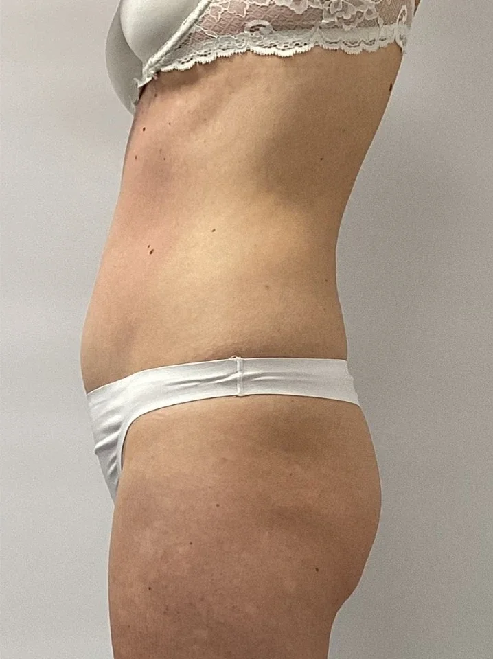 8After 10 sessions.webp
