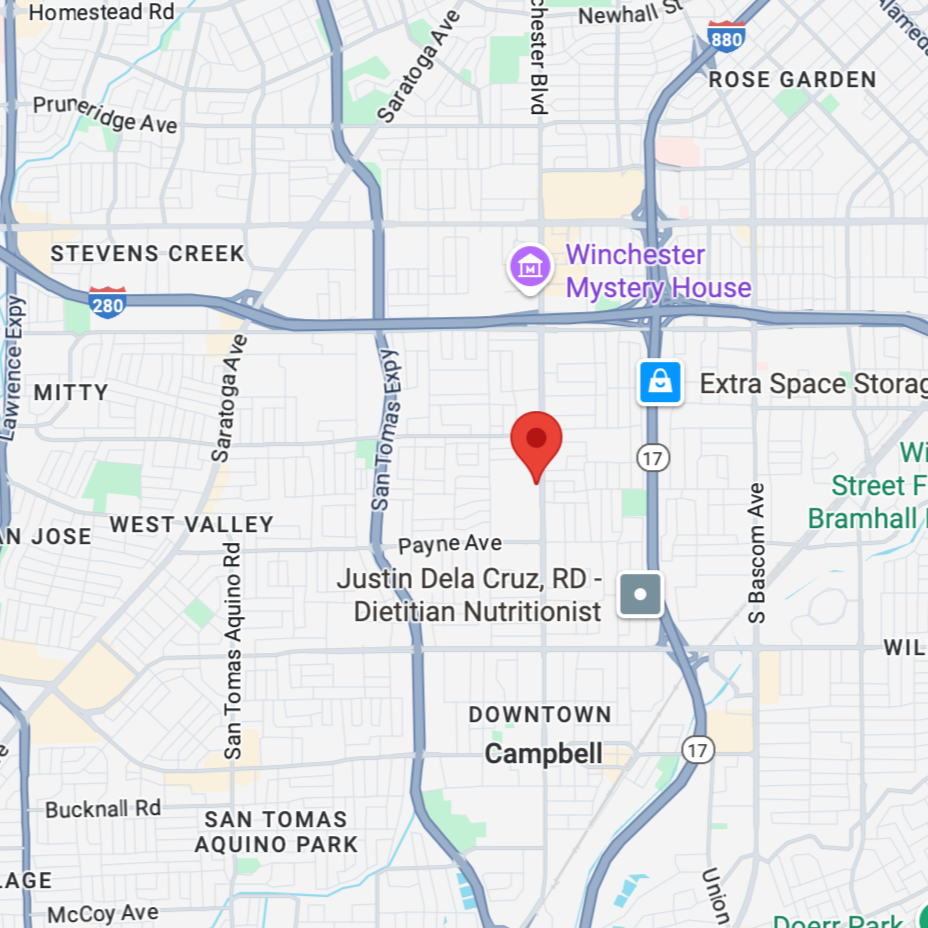 Map showing the location of Lymph Me Up Studio on South Winchester Boulevard in San Jose.
