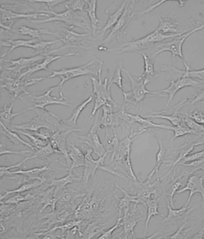 Human mesenchymal stem cells in cell culture