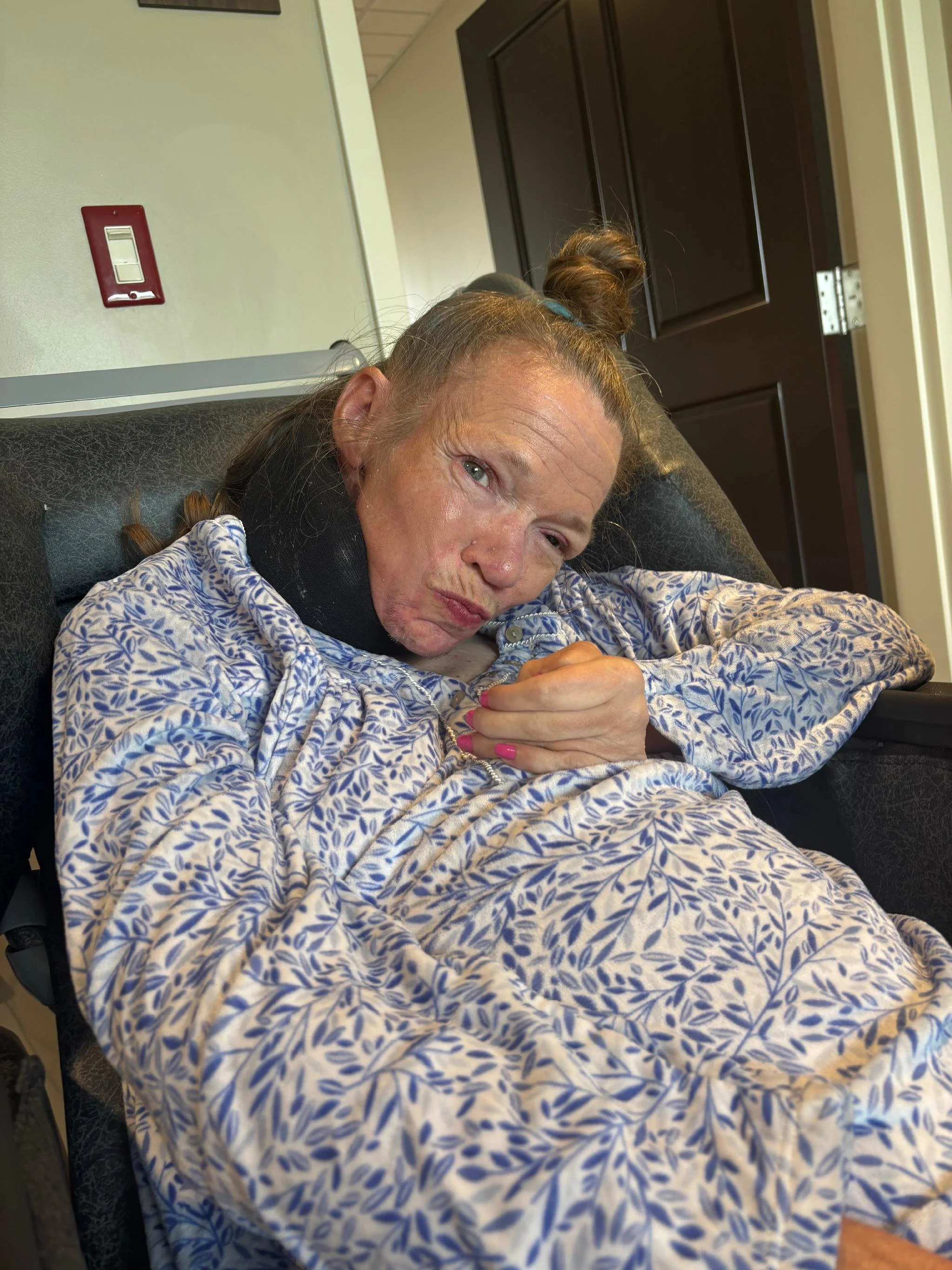 A woman with red hair tied in a top bun, possibly in a hospital or clinic setting, with visible scars and skin condition, wearing a comfortable gown with a blue and white leaf pattern, sitting on a black textured armchair.