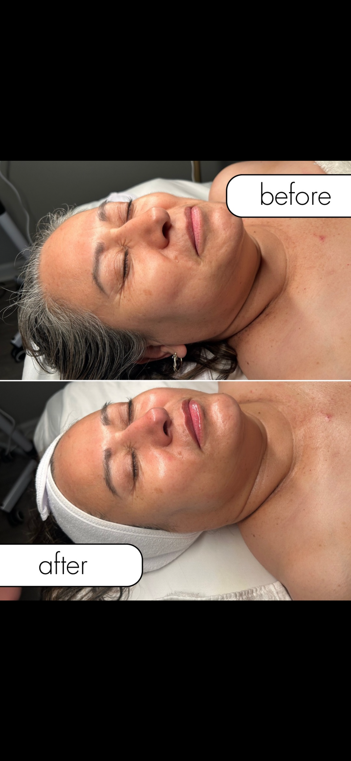 Firming Peptide Facial