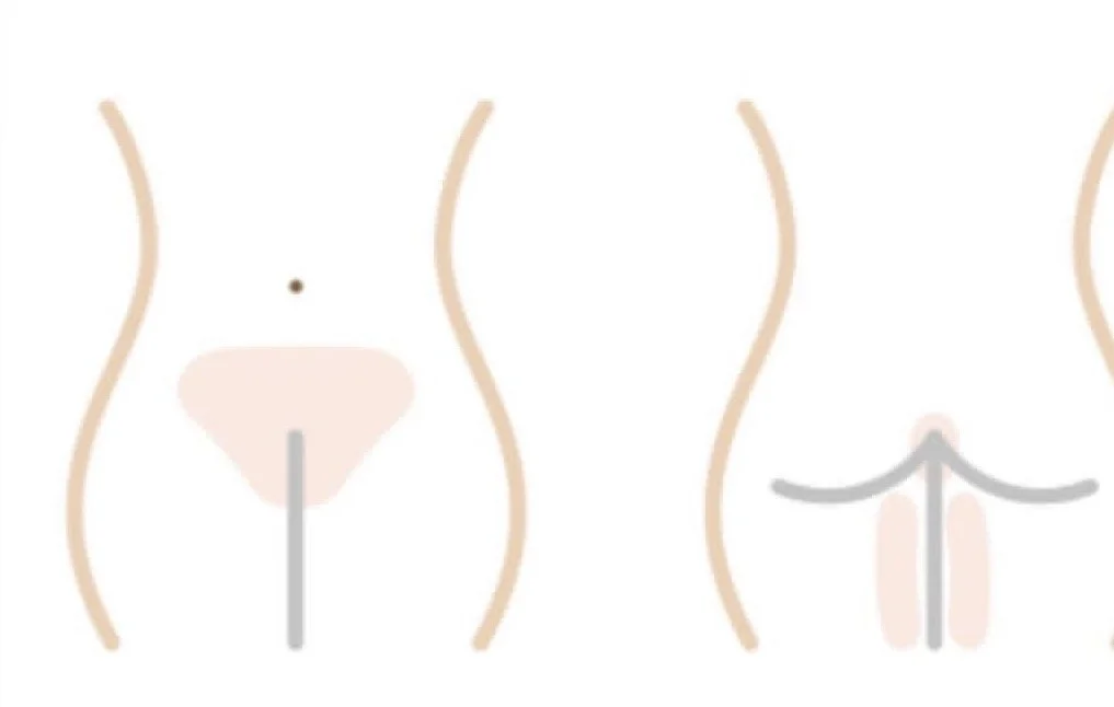 Brazilian Wax