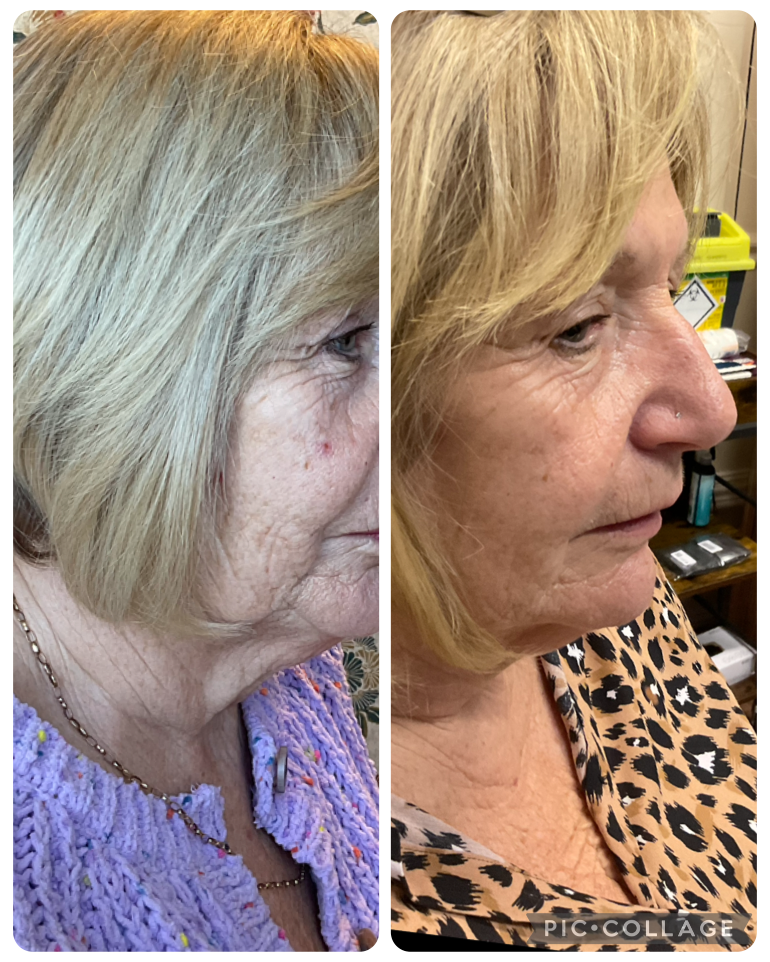Side-by-side comparison of a woman before and after a hair treatment, showing her ombre blonde hair and facial features.