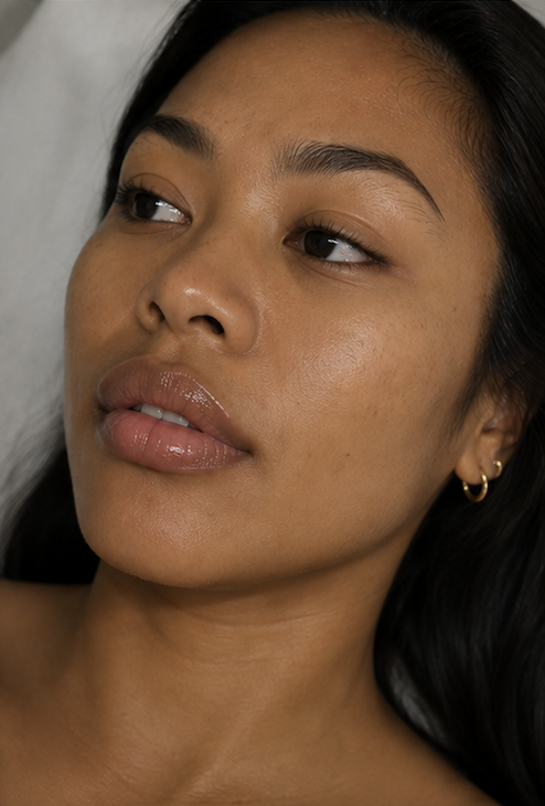 Clinical Photos of treatments performed at Zorélia Aesthetics Perth.