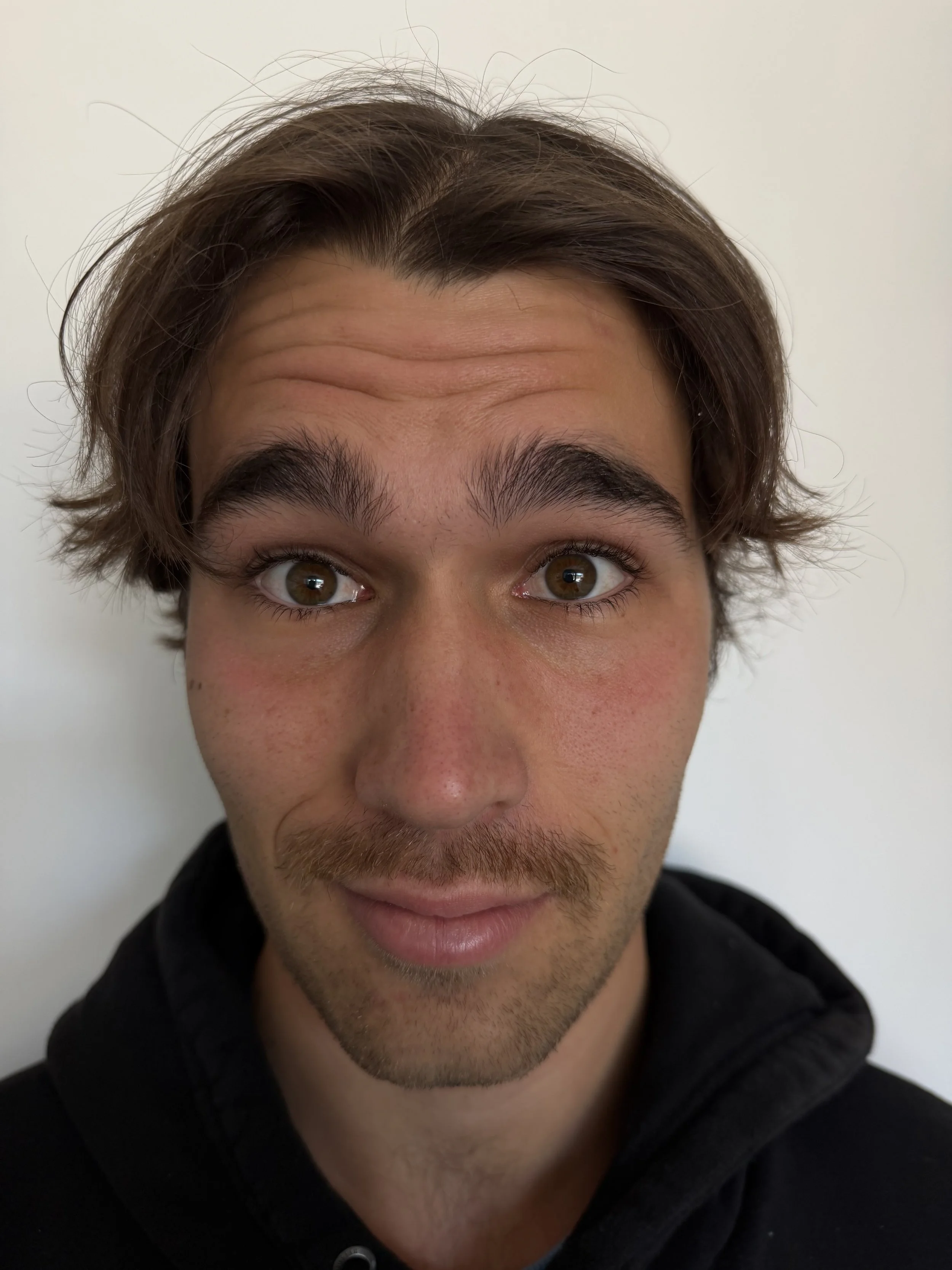 Close-up of a young man, clinical photos for Zorélia Aesthetics.
