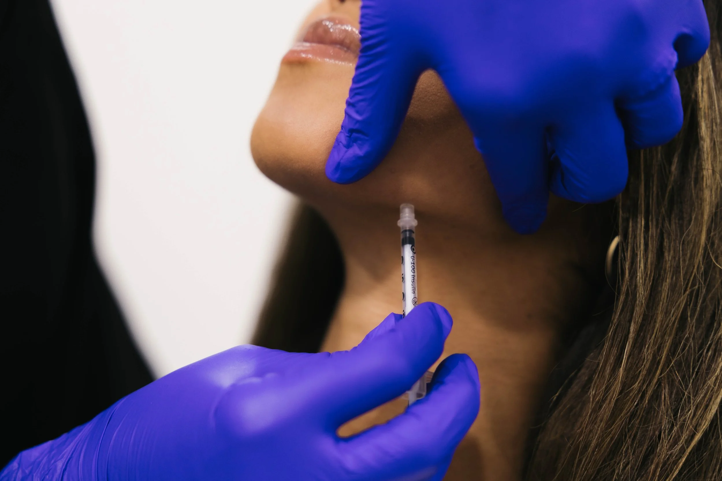 A woman with long brown hair receiving an injection in her face from a medical professional wearing black gloves in a clinical setting.