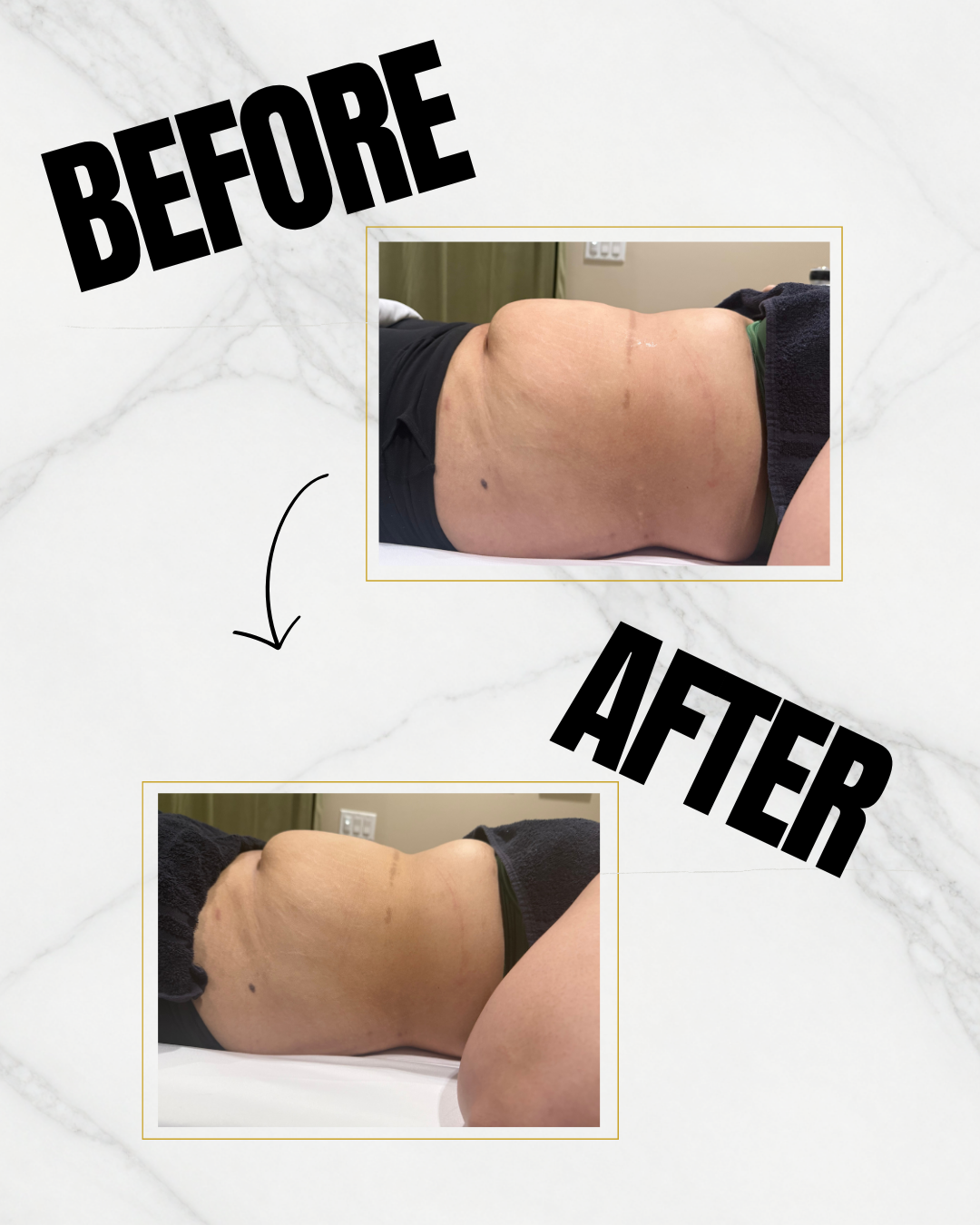 Client before and after 1st session!