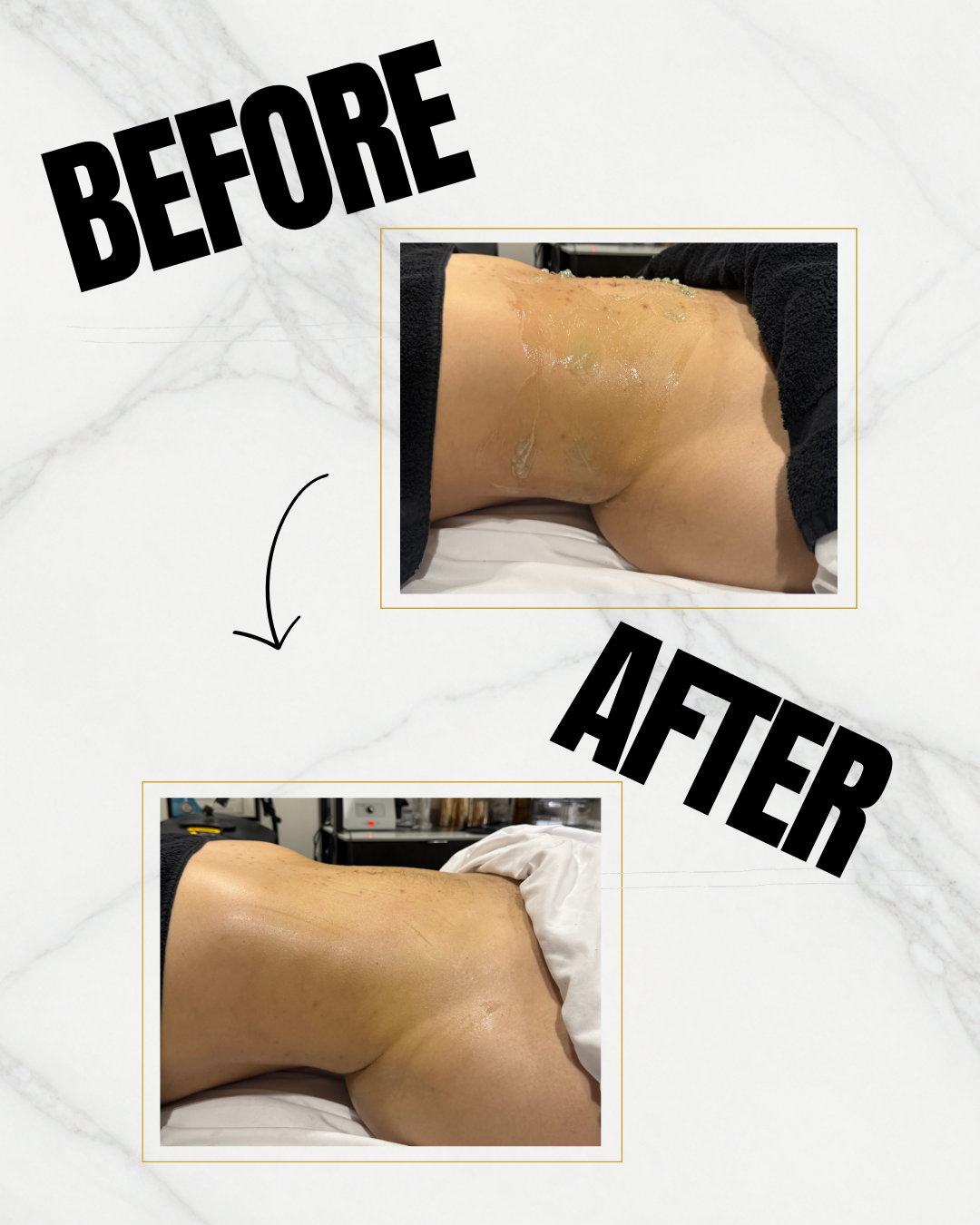 Client after one session!