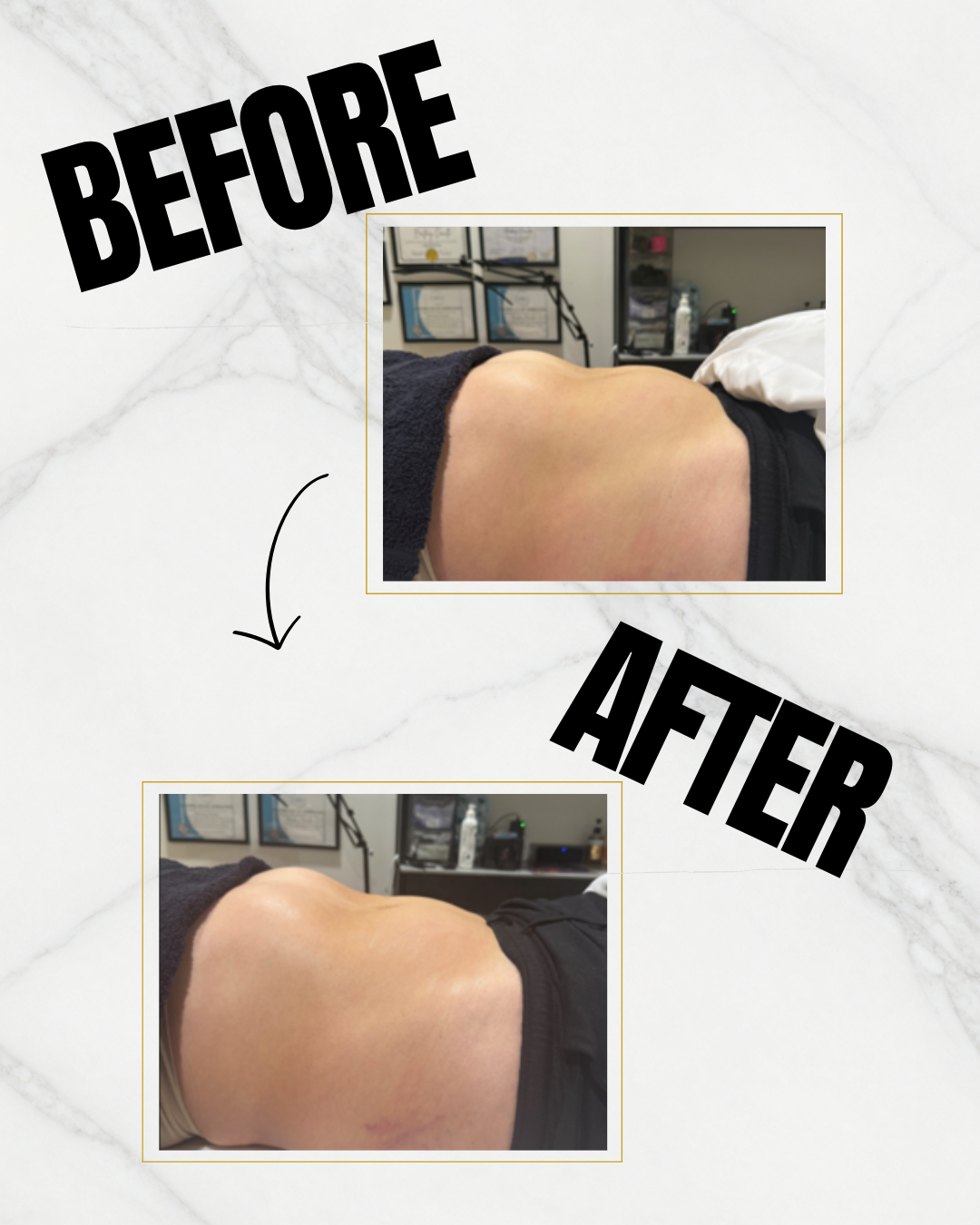Black Grey Beauty Treatments Before After Collage Instagram Post - Client 14.png