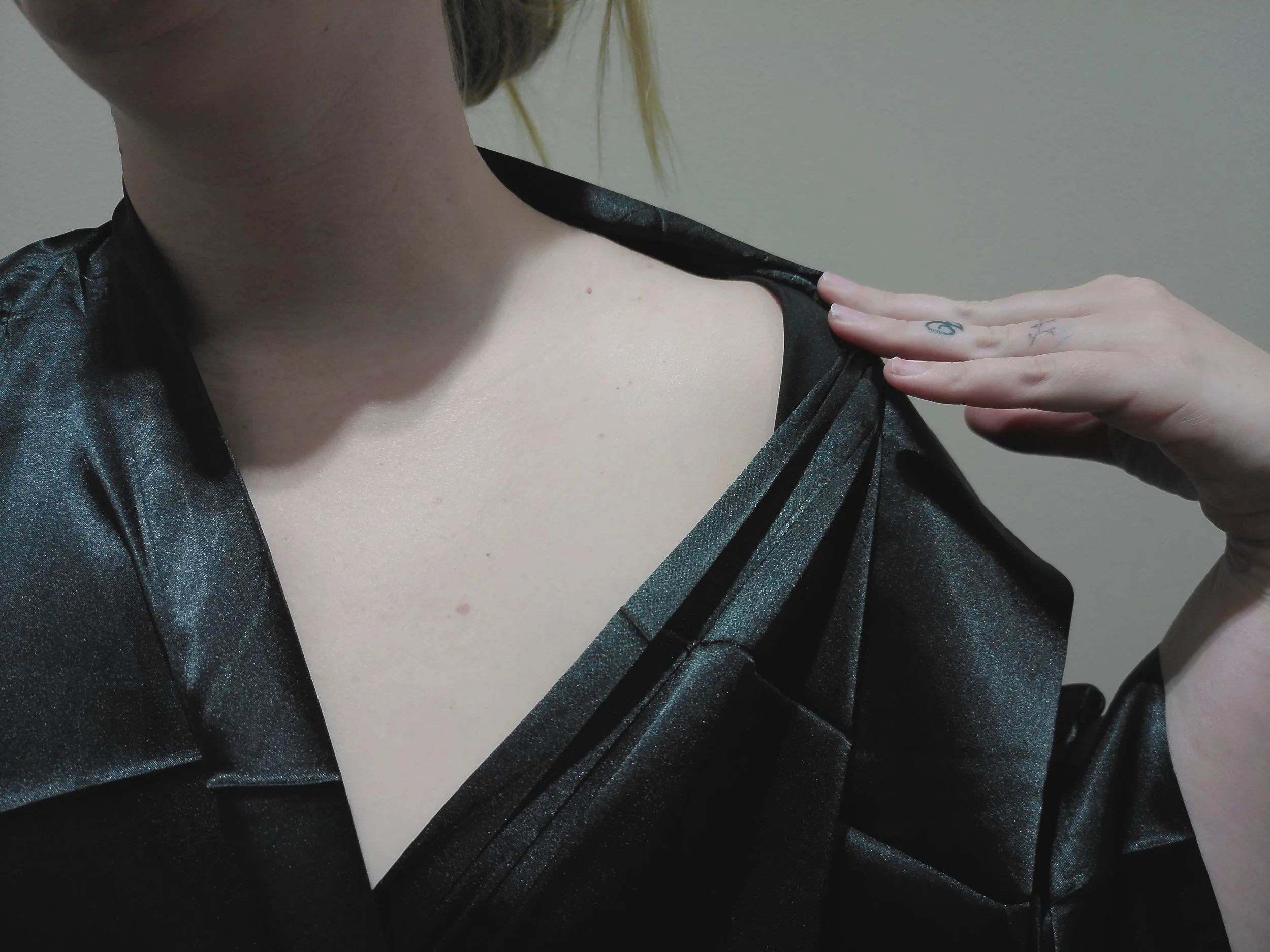 Client 1 - Before Shoulder