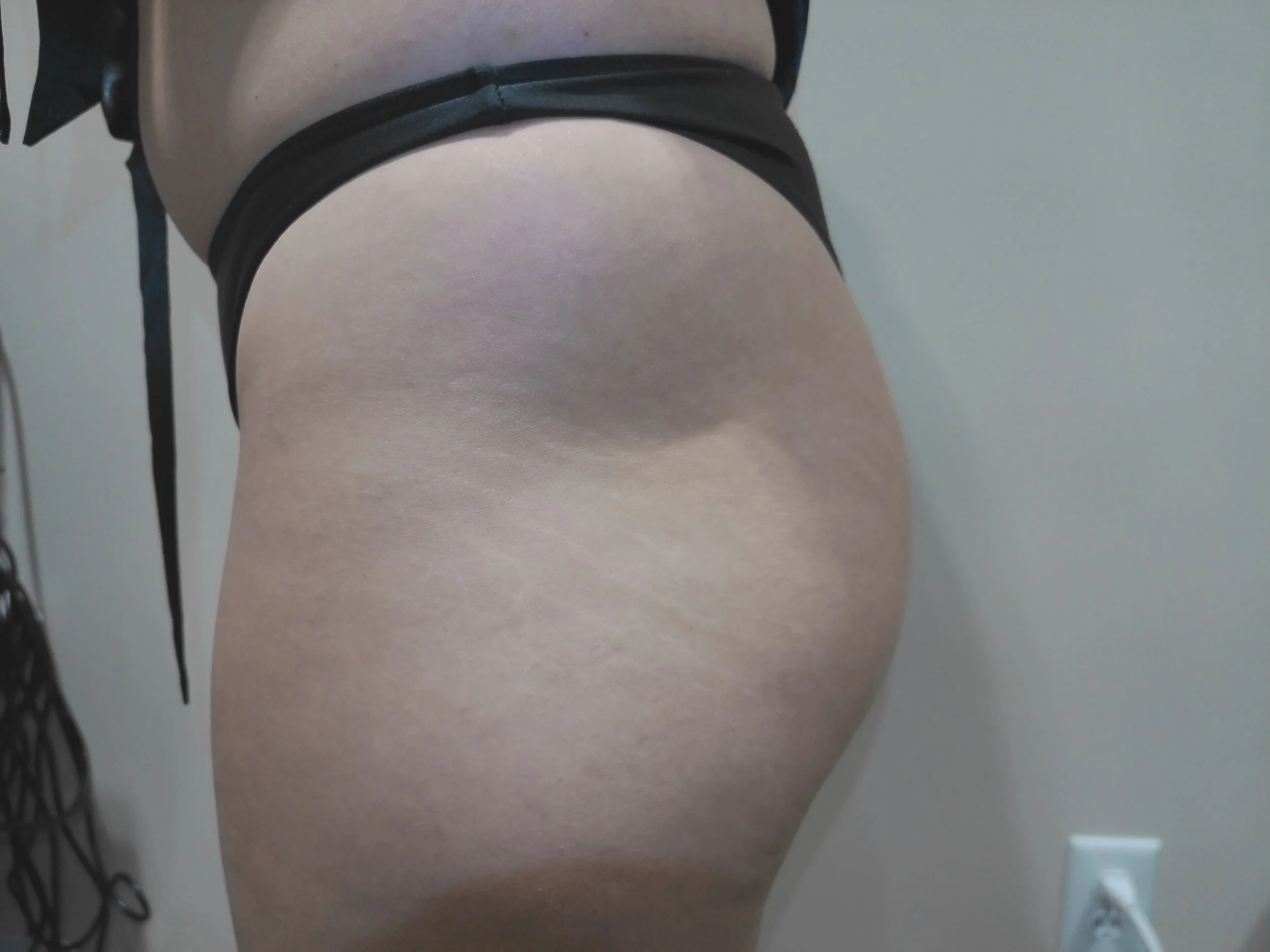 Client 2 - Hip Before