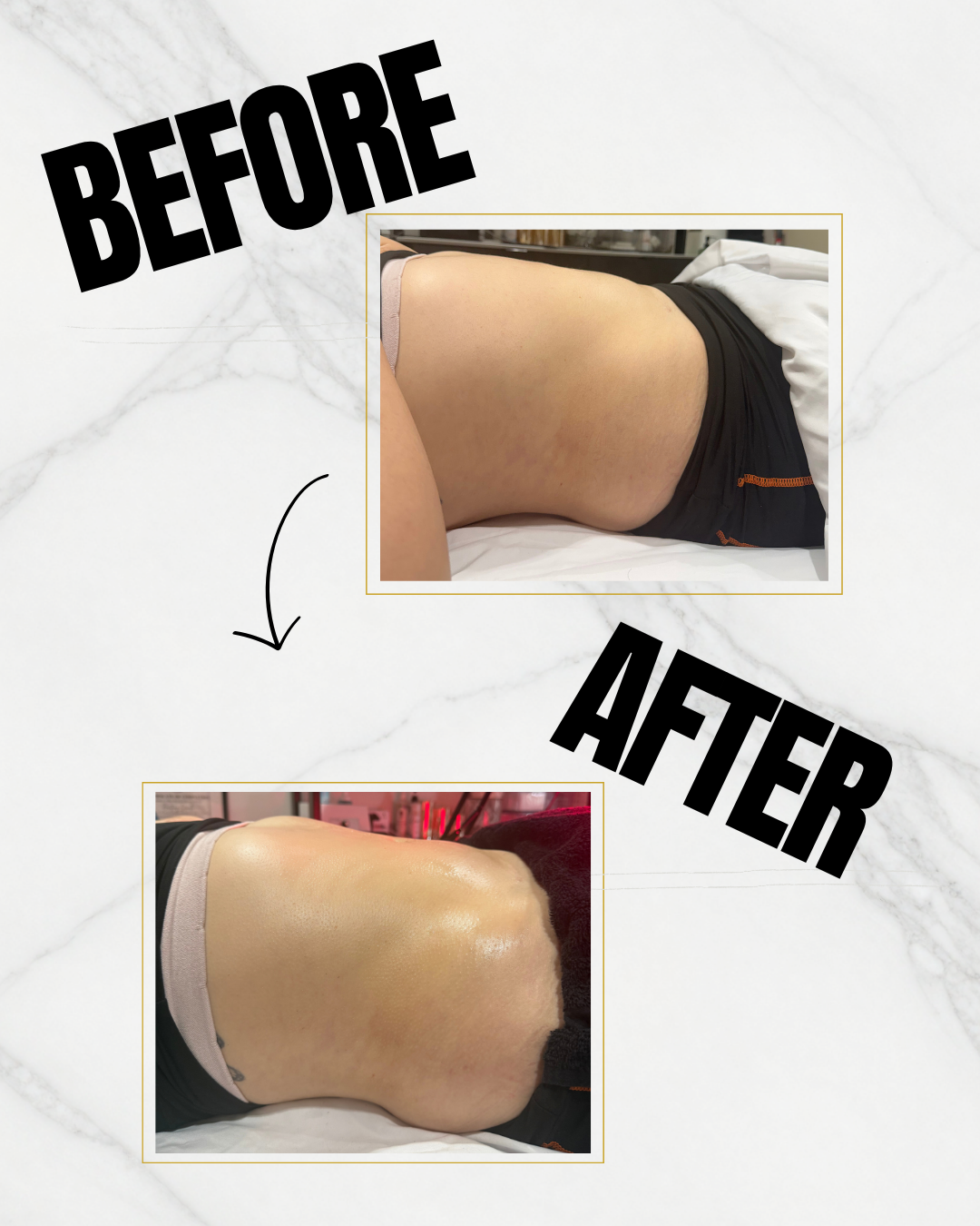 Black Grey Beauty Treatments Before After Collage Instagram Post - Client 13.png