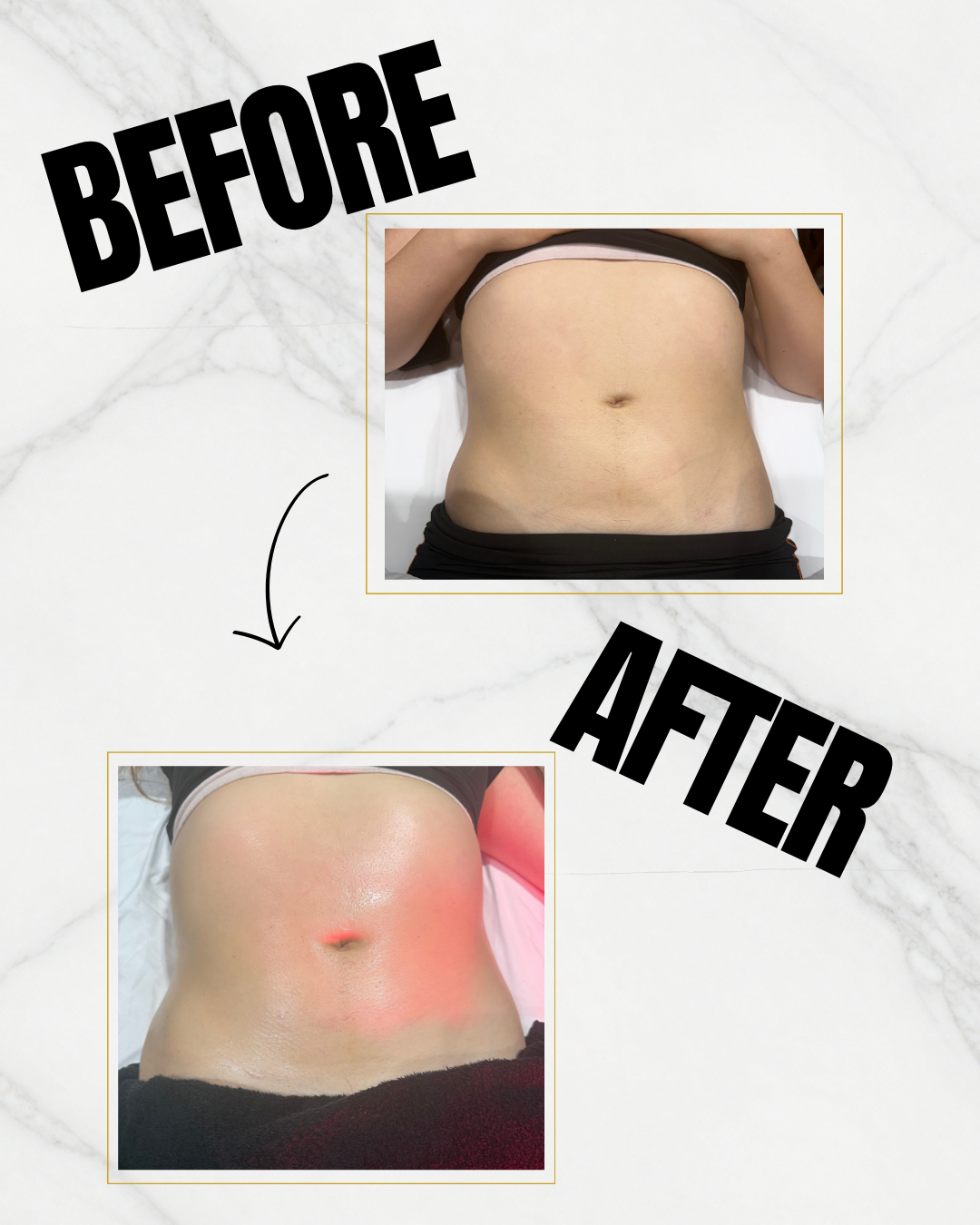 Black Grey Beauty Treatments Before After Collage Instagram Post - Client 12.png