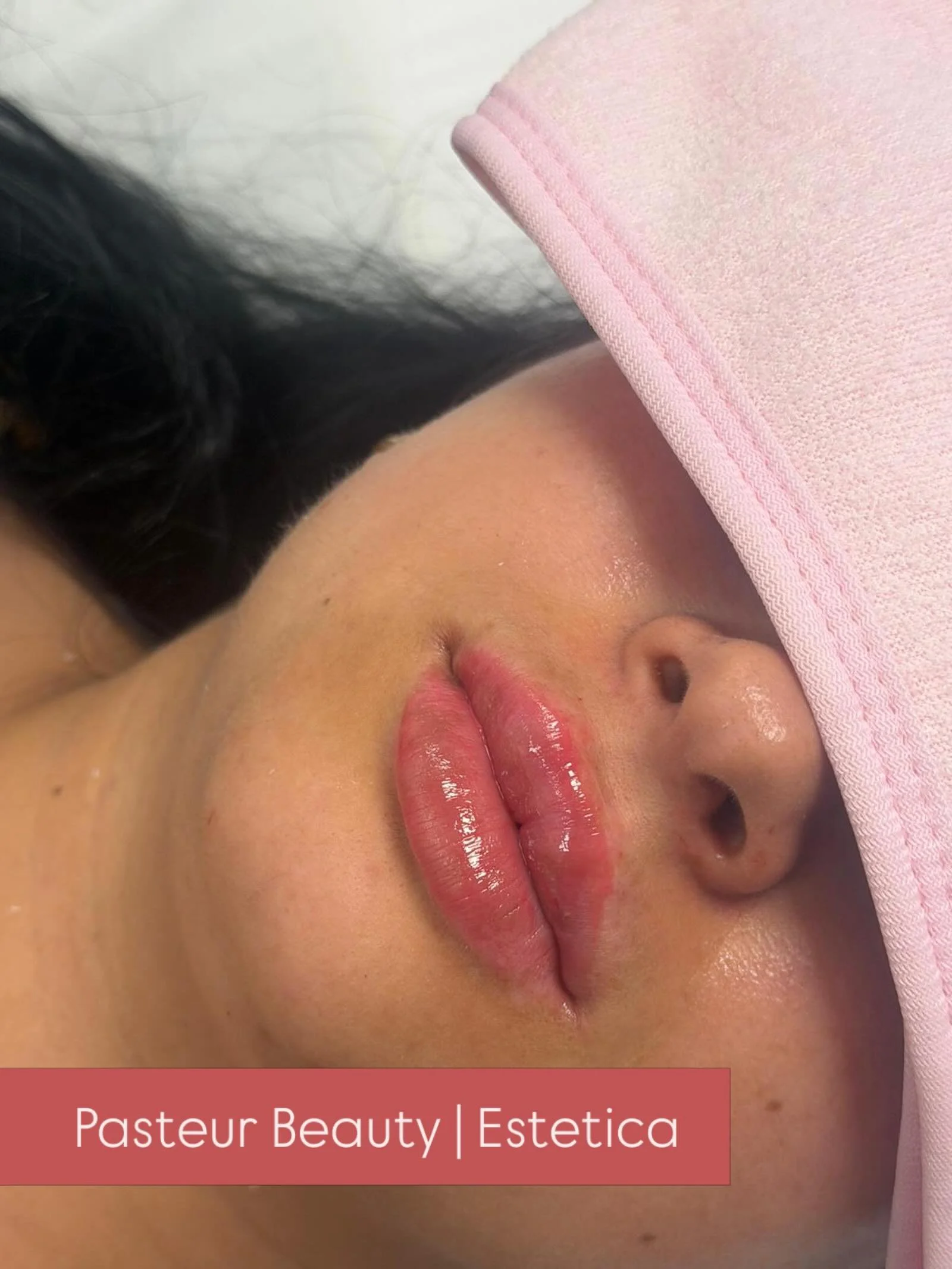📍 Hamburg | Pasteur Beauty
&bull;
&bull;
&bull;
&bull;
&bull;
#hamburg #harburg #hyaluron #botox #sch&ouml;nheitsklinik