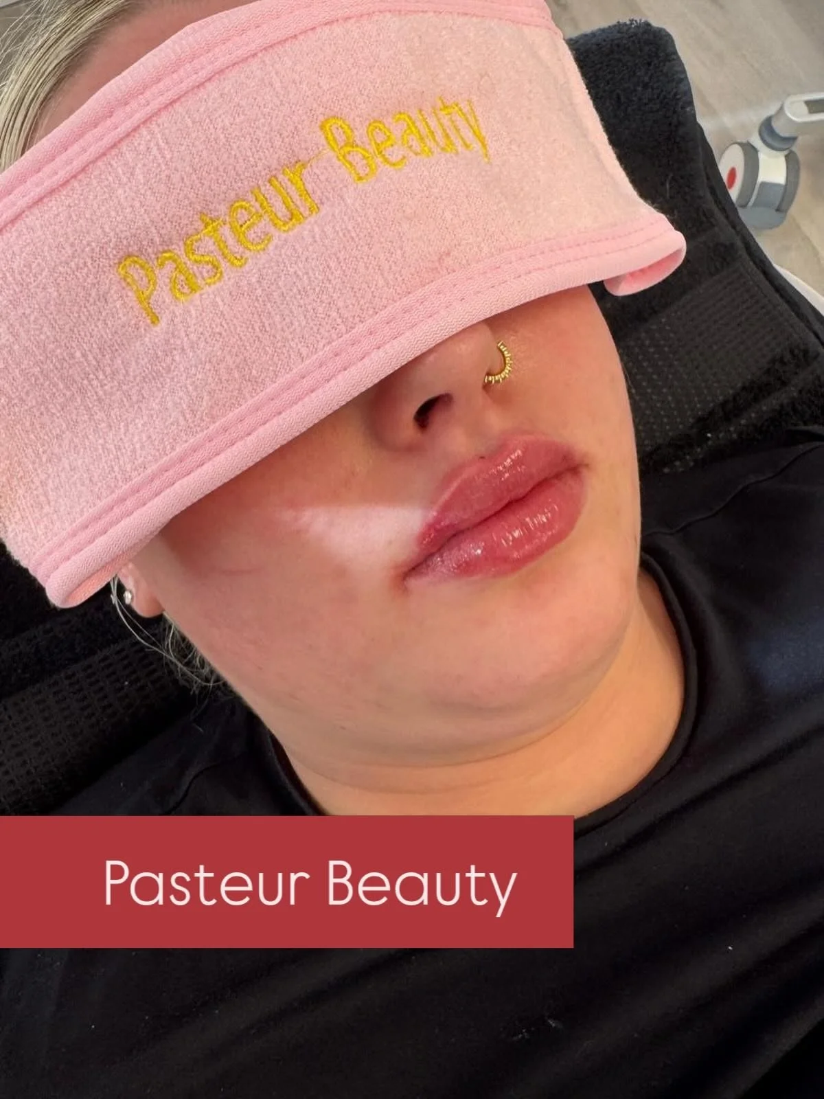 📍 Hamburg 
&bull;
&bull;
&bull;
&bull;
#lippen #hamburg #harburg #botox #endolift