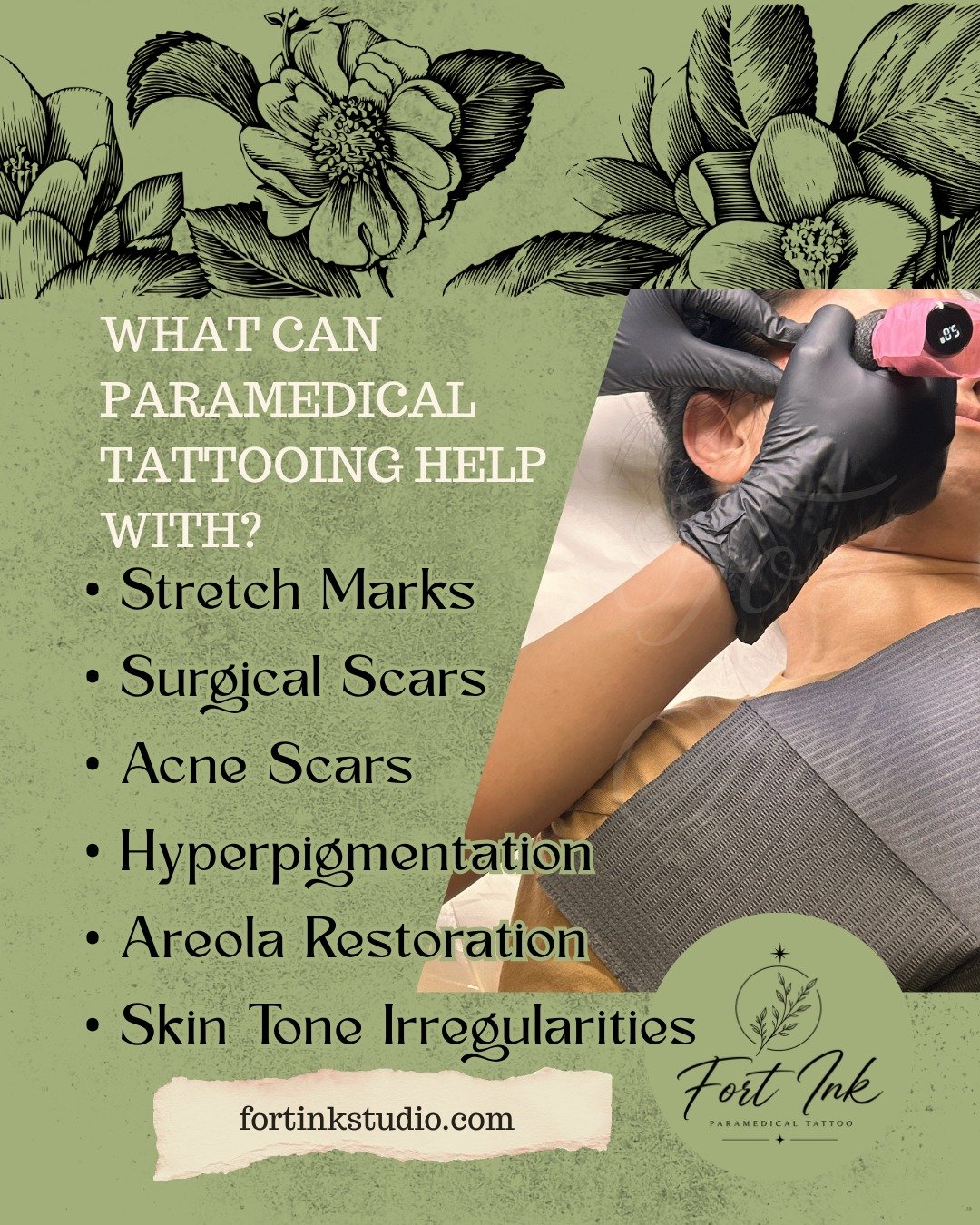 Most people have never heard of paramedical tattooing until they need it.

These treatments are designed to help improve the appearance of scars, stretch marks, pigmentation concerns, and other skin imperfections.

My goal is simple: help people feel