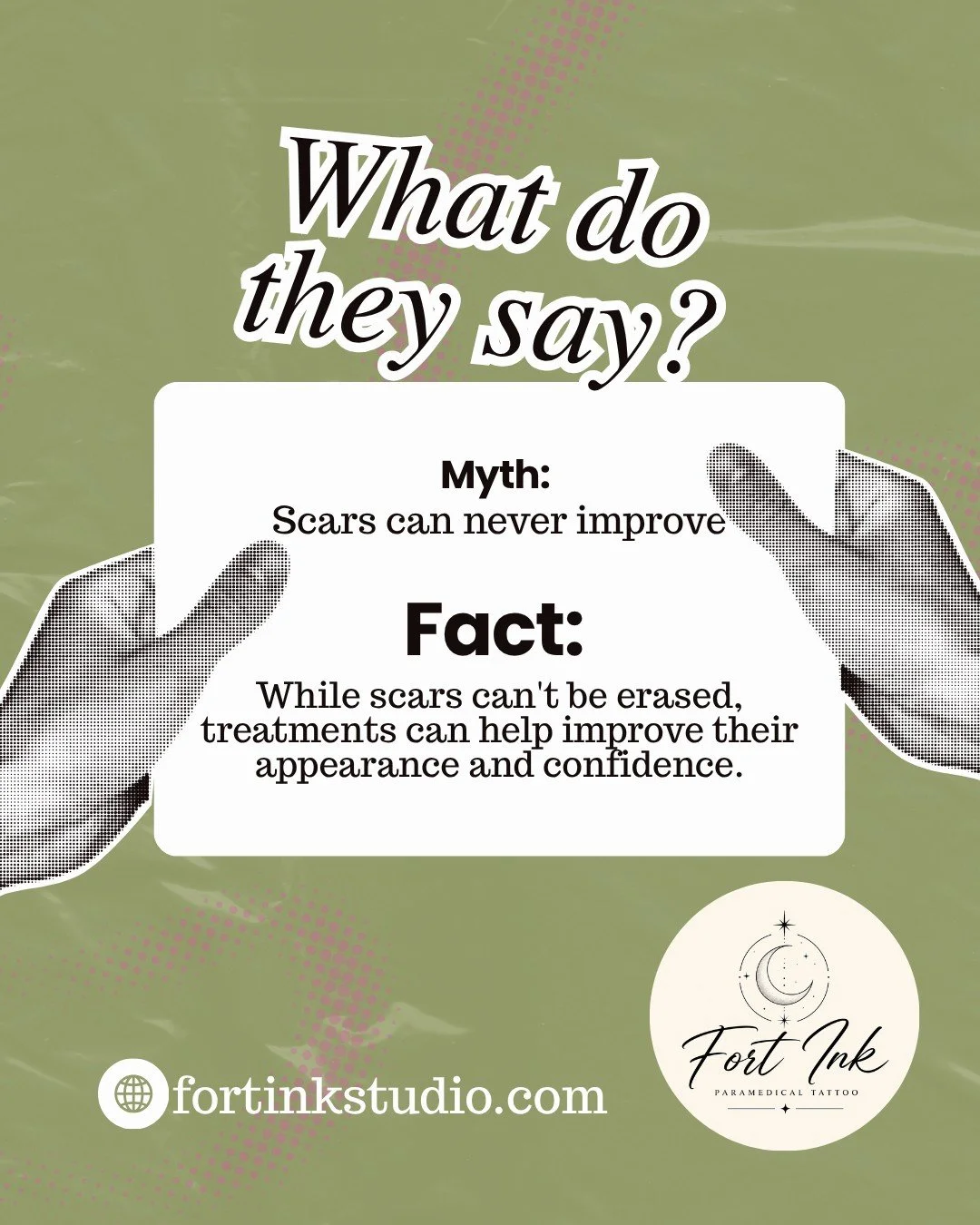 SCAR MYTH #1

Many people believe scars can never improve.

While scars can't be erased completely, treatments may help improve their appearance and restore confidence.

Every scar is different, which is why consultations are so important.

What scar