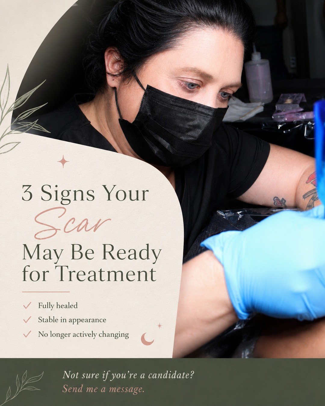 ✨ Is your scar ready for treatment?

One of the most important factors in scar revision is timing. While every scar is unique, there are a few signs that may indicate you're ready to begin your treatment journey.

💚 Fully healed
💚 Stable in appeara