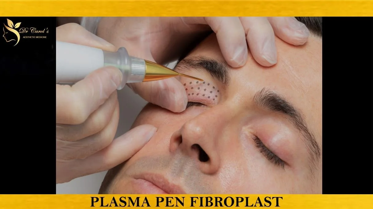 PLASMA PEN FIBROPLASTY.JPG