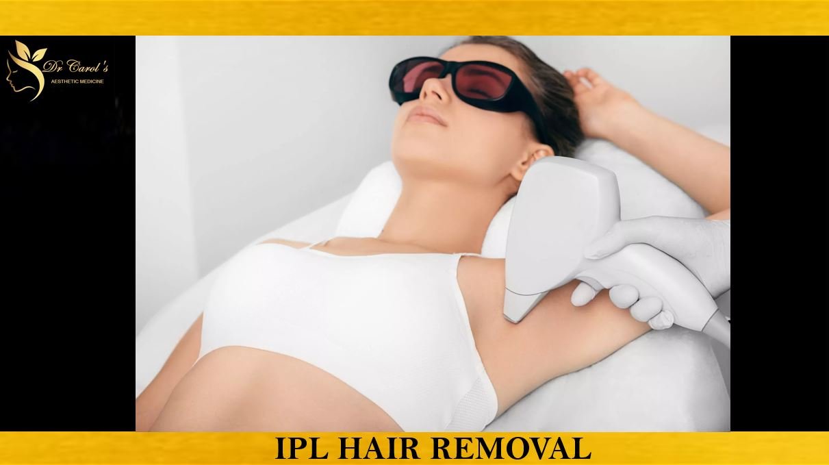 IPL HAIR REMOVAL.JPG