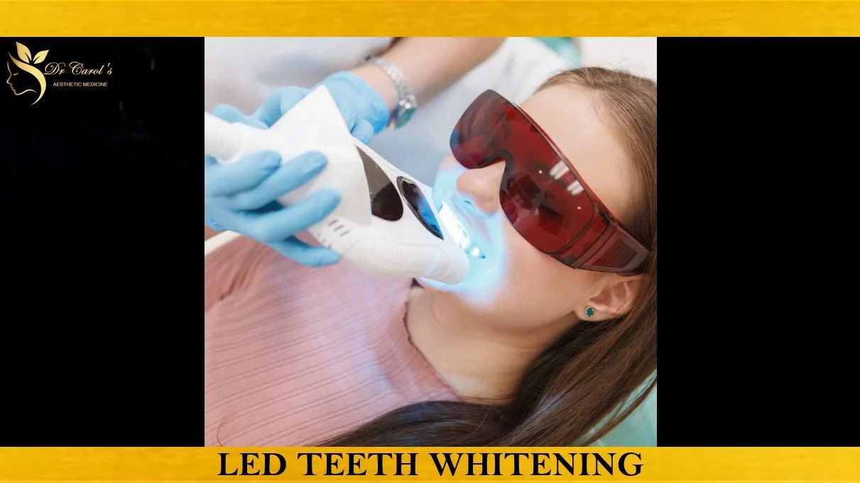 LED TEETH WHITENING.JPG