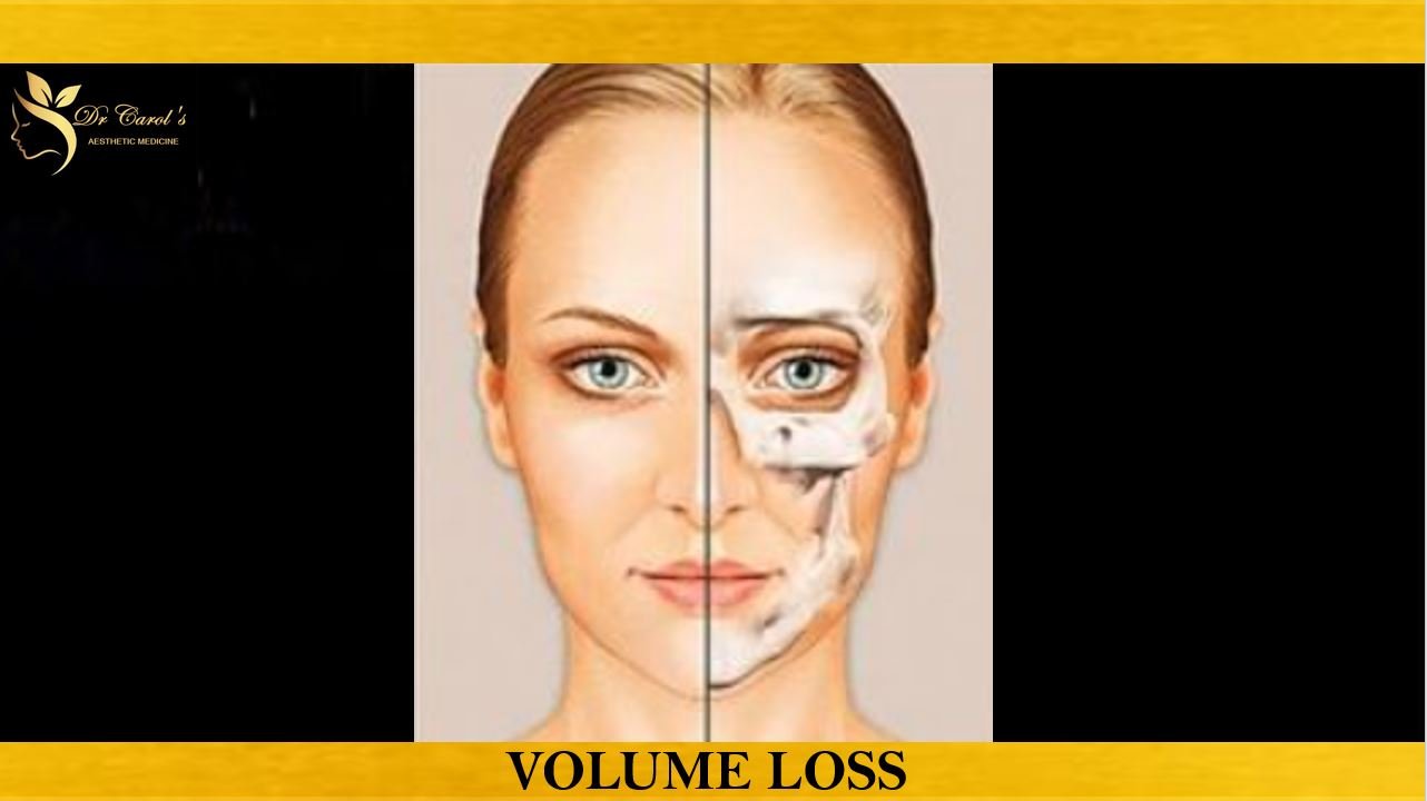 Volume loss TGA.JPG