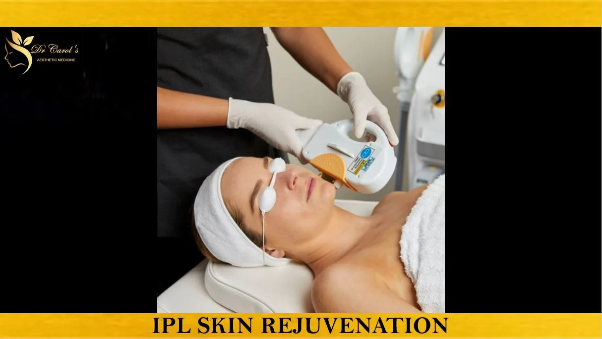 IPL SKIN REJUVENATION.JPG