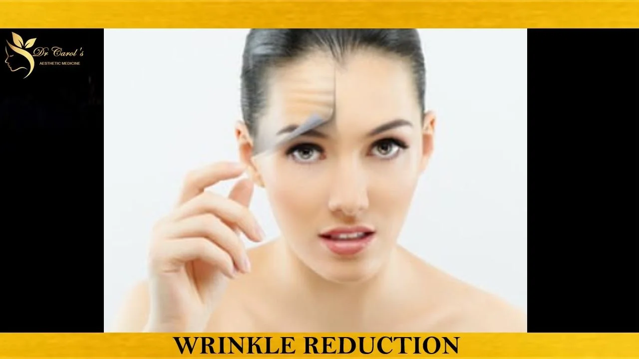 Wrinkle reduction TGA.JPG