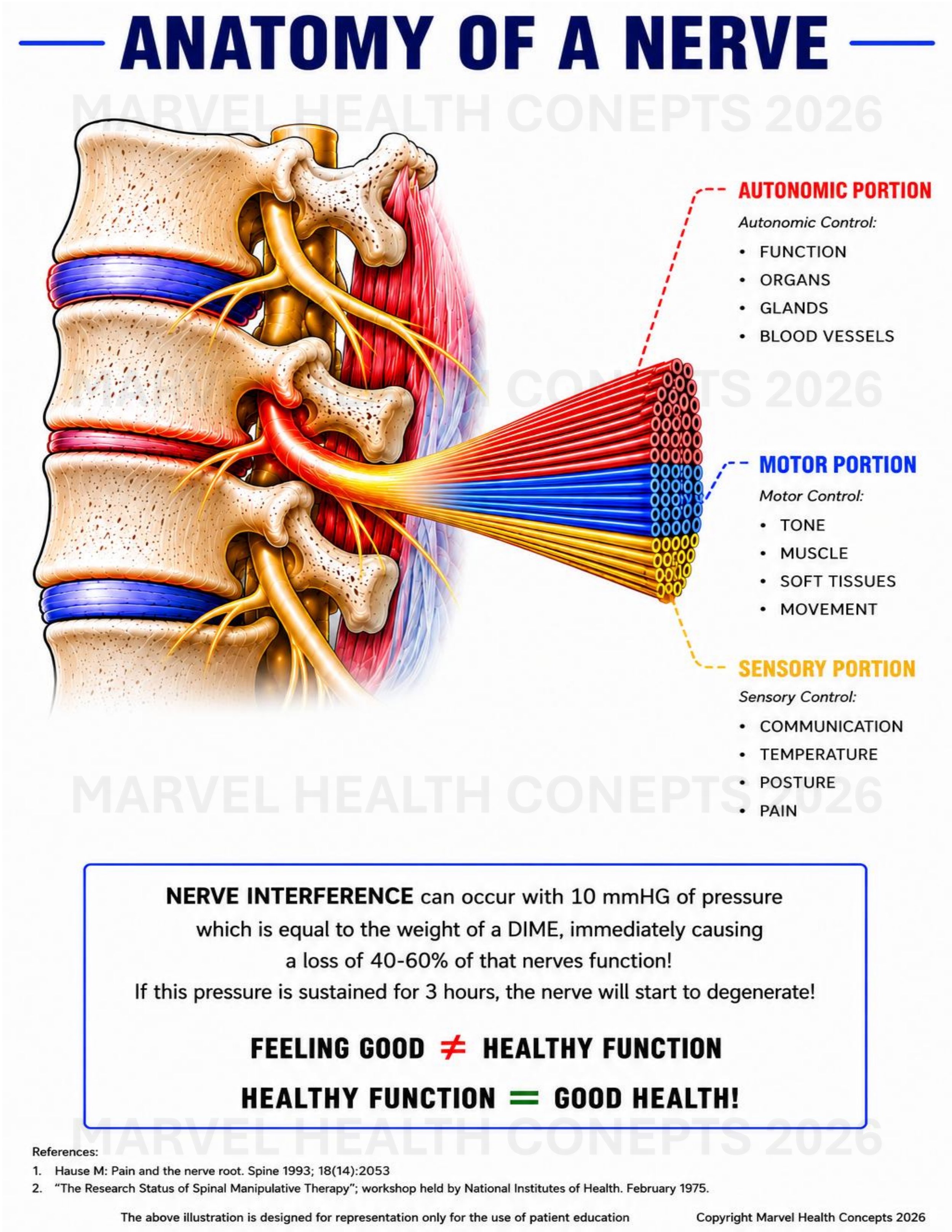 Illustration of vertebral subluxation & spinal nerve root anatomy demonstrating the relationship between the vertebral column and the nervous system. The graphic renders color-coded sensory (afferent), motor (efferent), and autonomic nerve pathways.