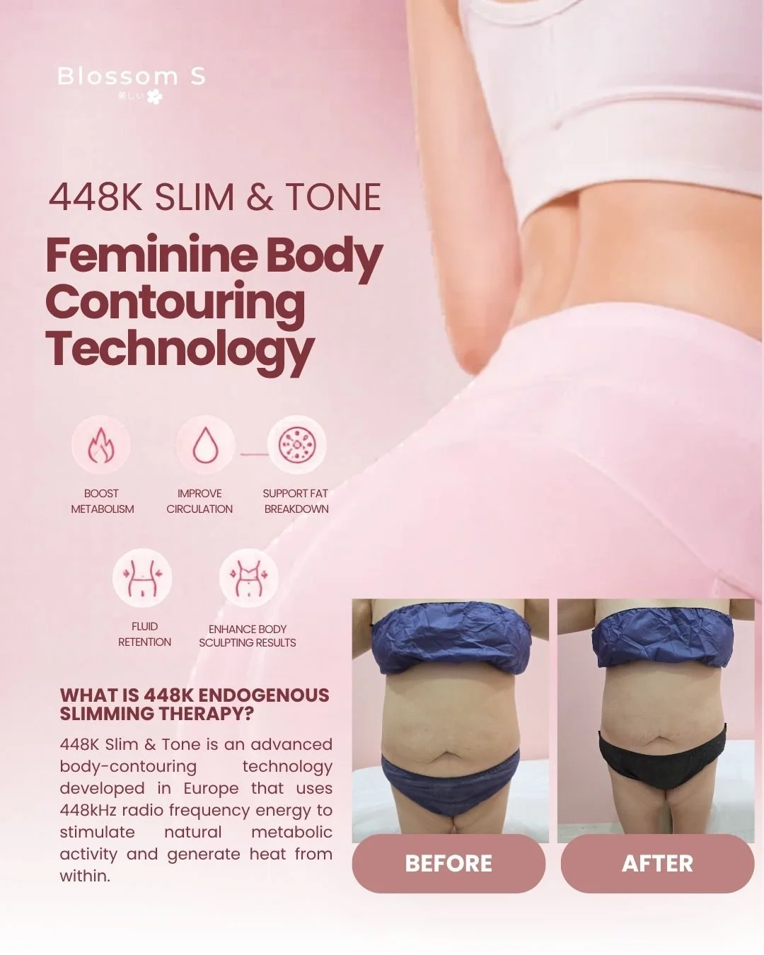 448K Slim & Tone — Feminine Body Contouring
