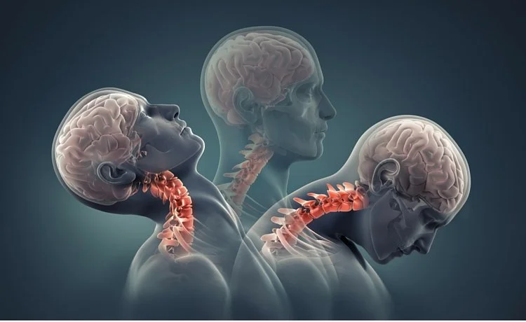 Whiplash &amp; Car Accident Injury Care in Mineola