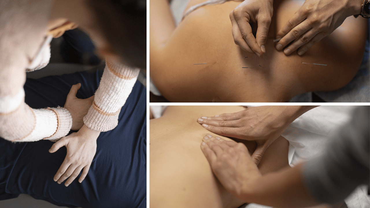 What Is Combined Care? Chiropractic and Acupuncture in One Visit