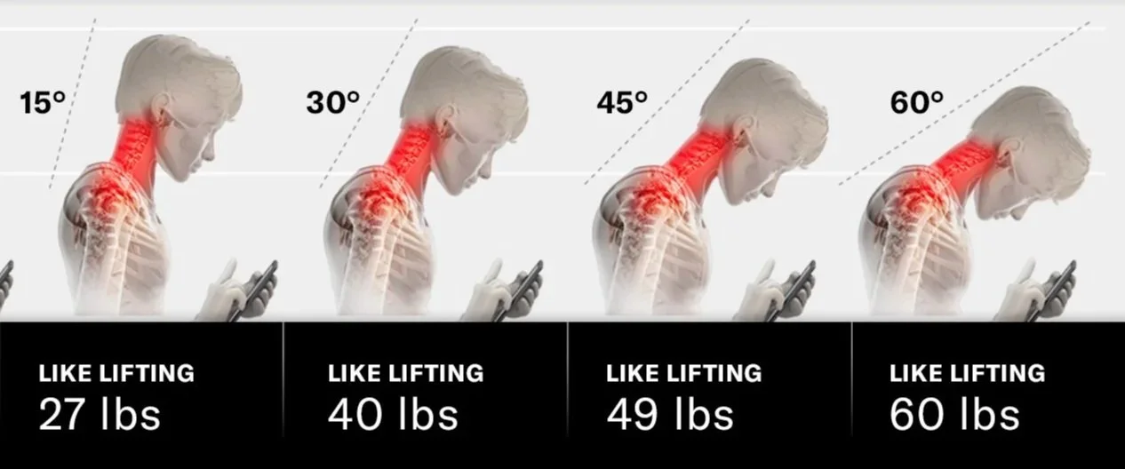 Neck Pain &amp; Tech Neck: Relief in Mineola