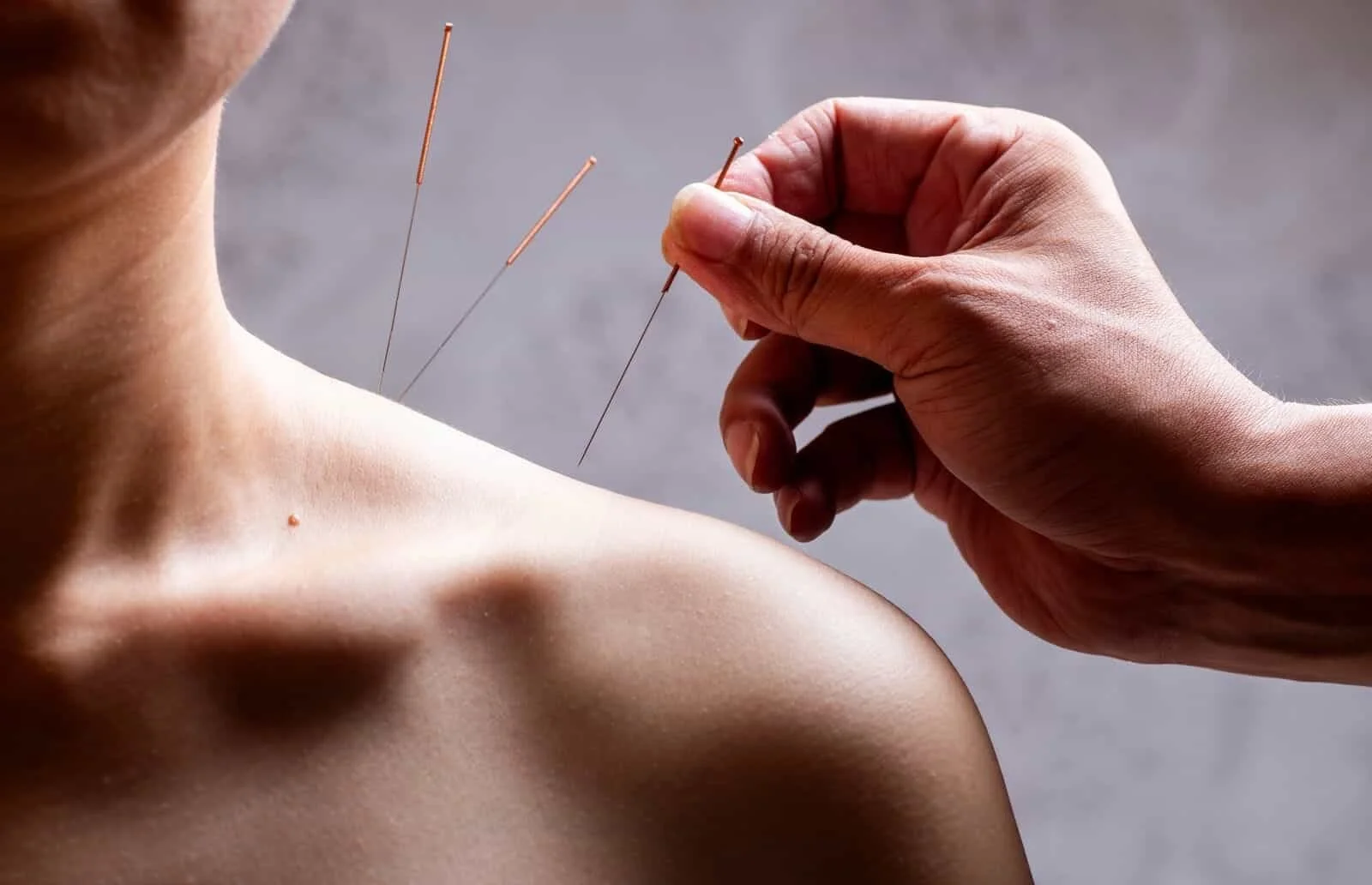 Acupuncture for shoulder pain in Mineola, NY