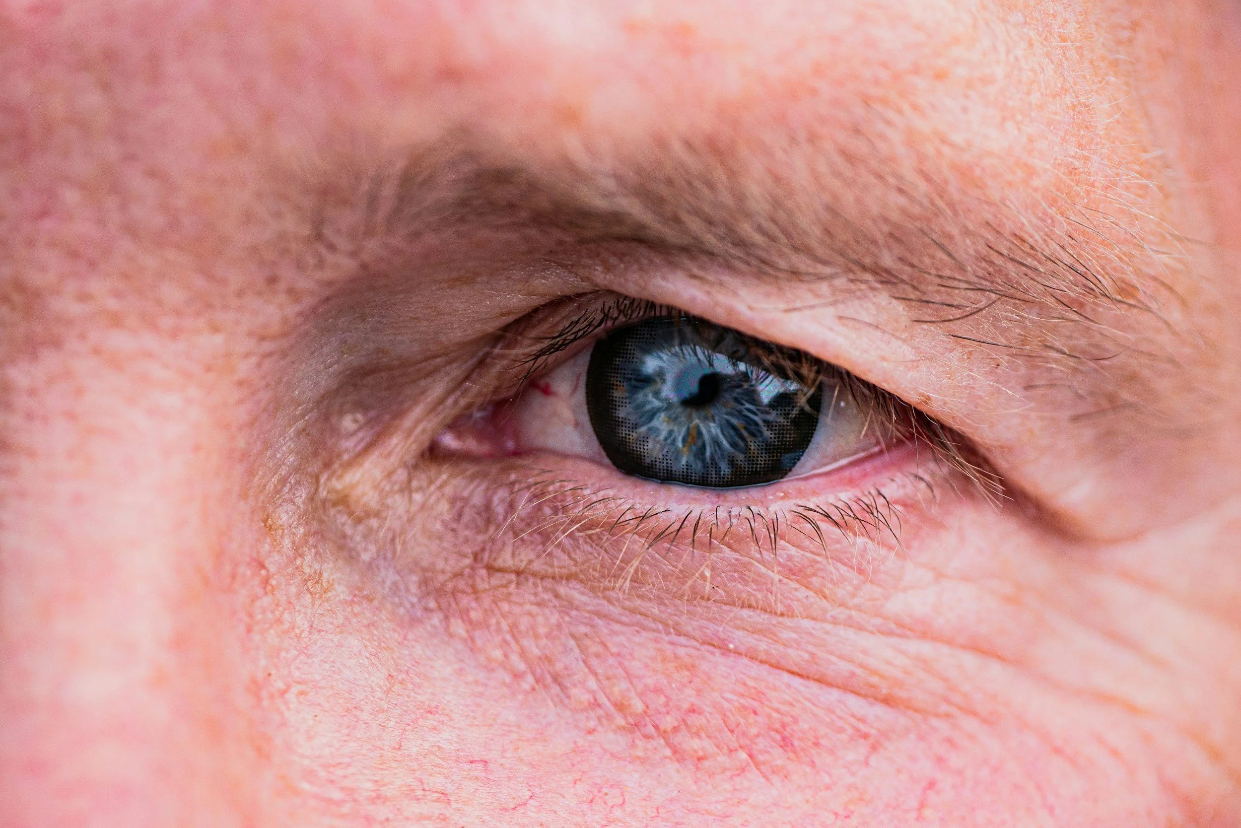 Living with Multiple Sclerosis — How Rehabilitation Helps You Stay Ahead of the Disease