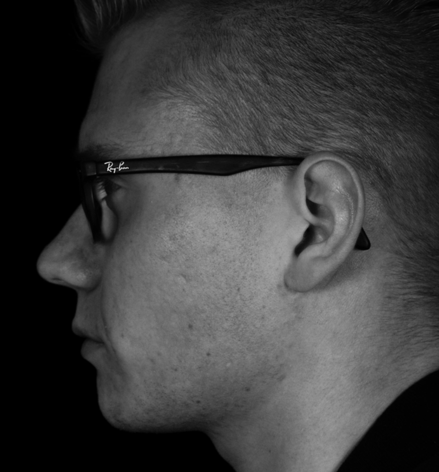 Close-up profile of a person wearing glasses, with short hair, in black and white.