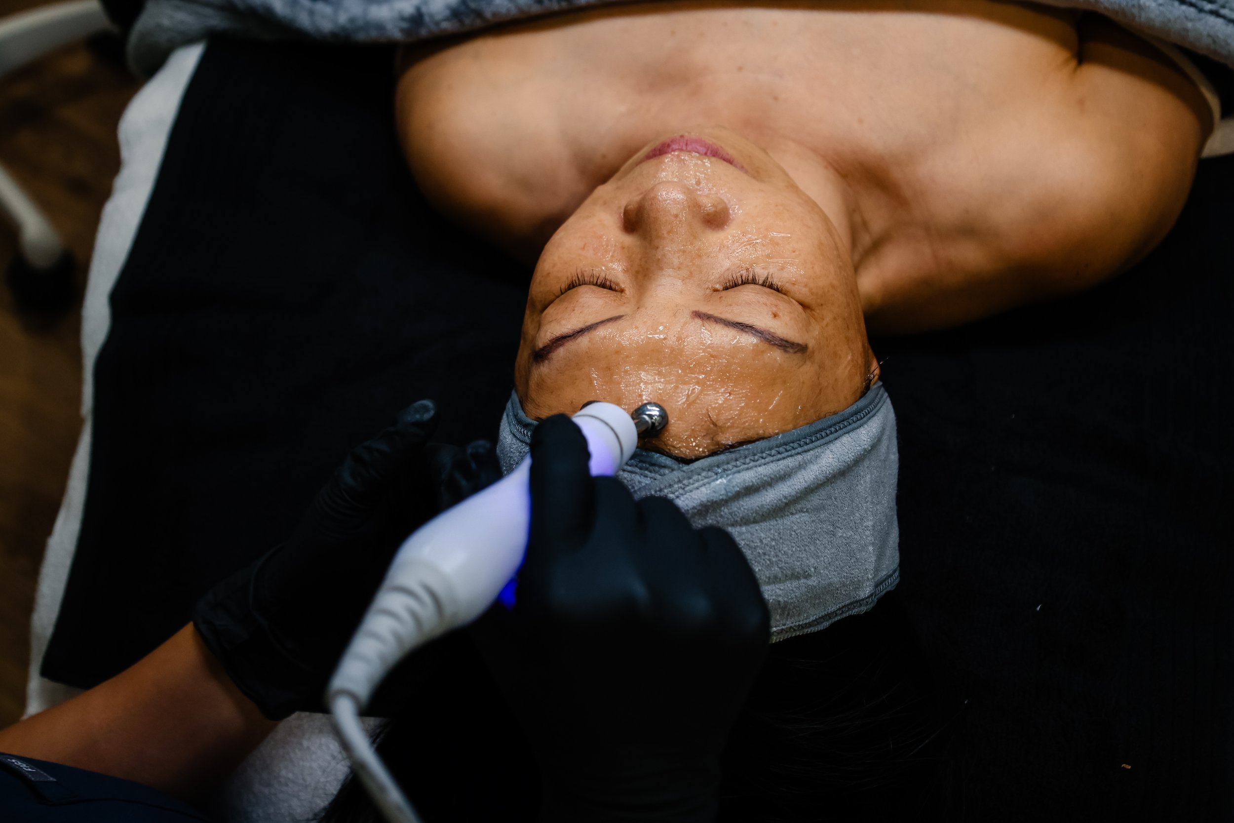 SKIN JOURNEY PACKAGE -Buy 3, Get the 4th FREE ON DELUXE HYDRADERMABRASION FACIALS