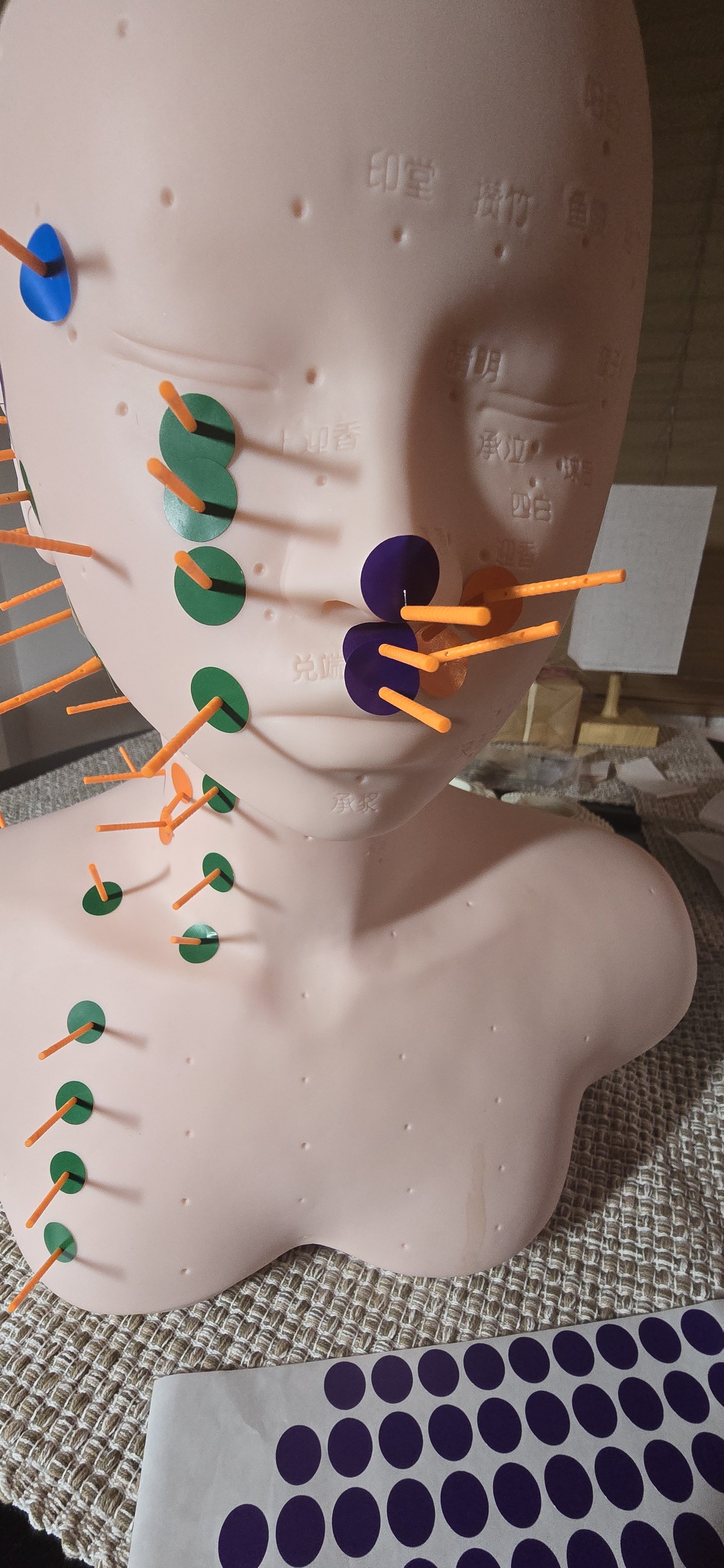 Acupuncture Stomach Channel, Ehlers Danlos Syndrome &amp; Cancers