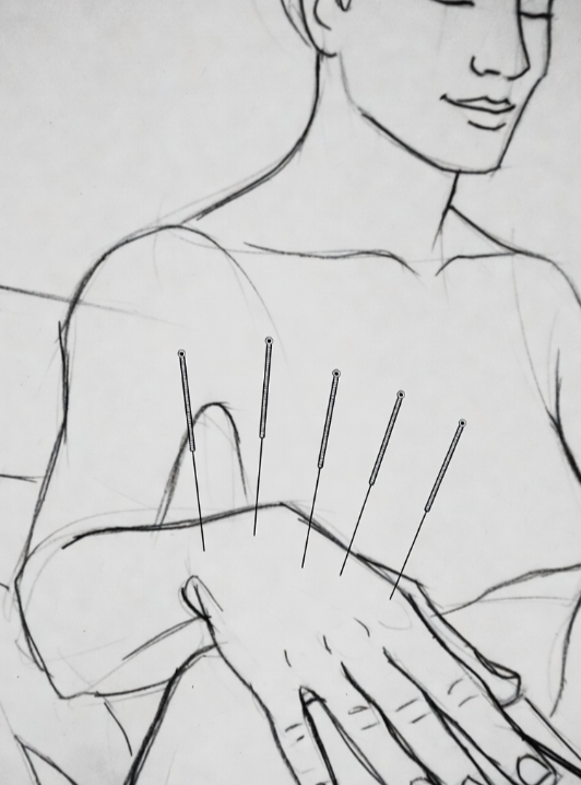 Cancer Sadness Management with Acupuncture