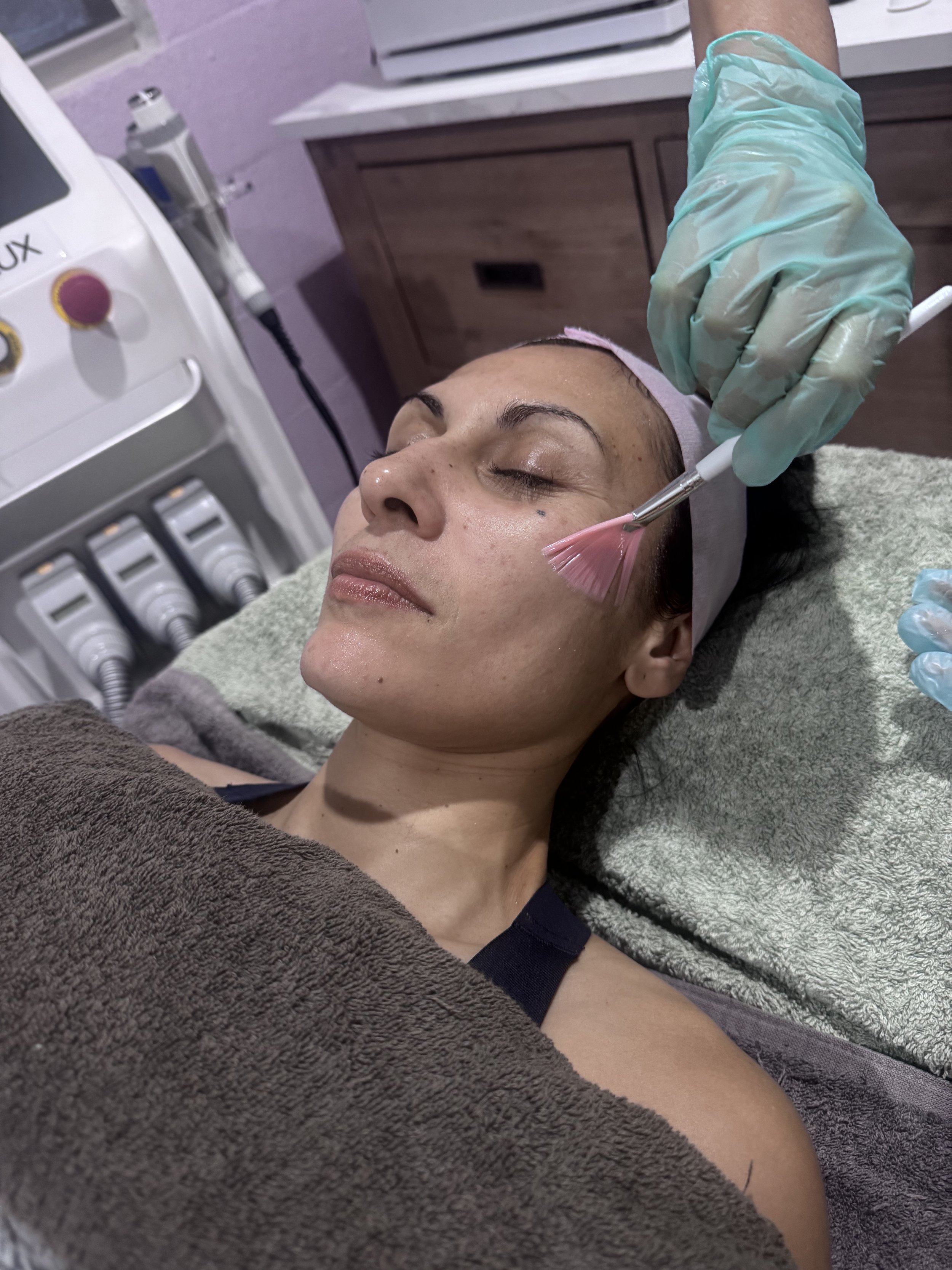 A woman lying on a treatment bed during a facial or skincare procedure, with a healthcare professional applying a facial treatment with a brush. The woman has her eyes closed and appears relaxed.