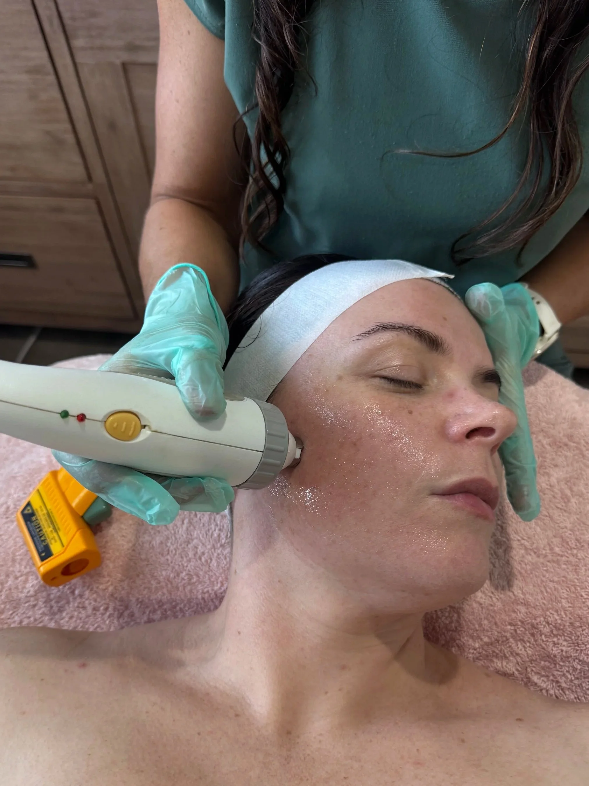 Close-up of a woman receiving a cosmetic treatment on her face, wearing a white headband, with a healthcare professional wearing gloves holding a device near her cheek.