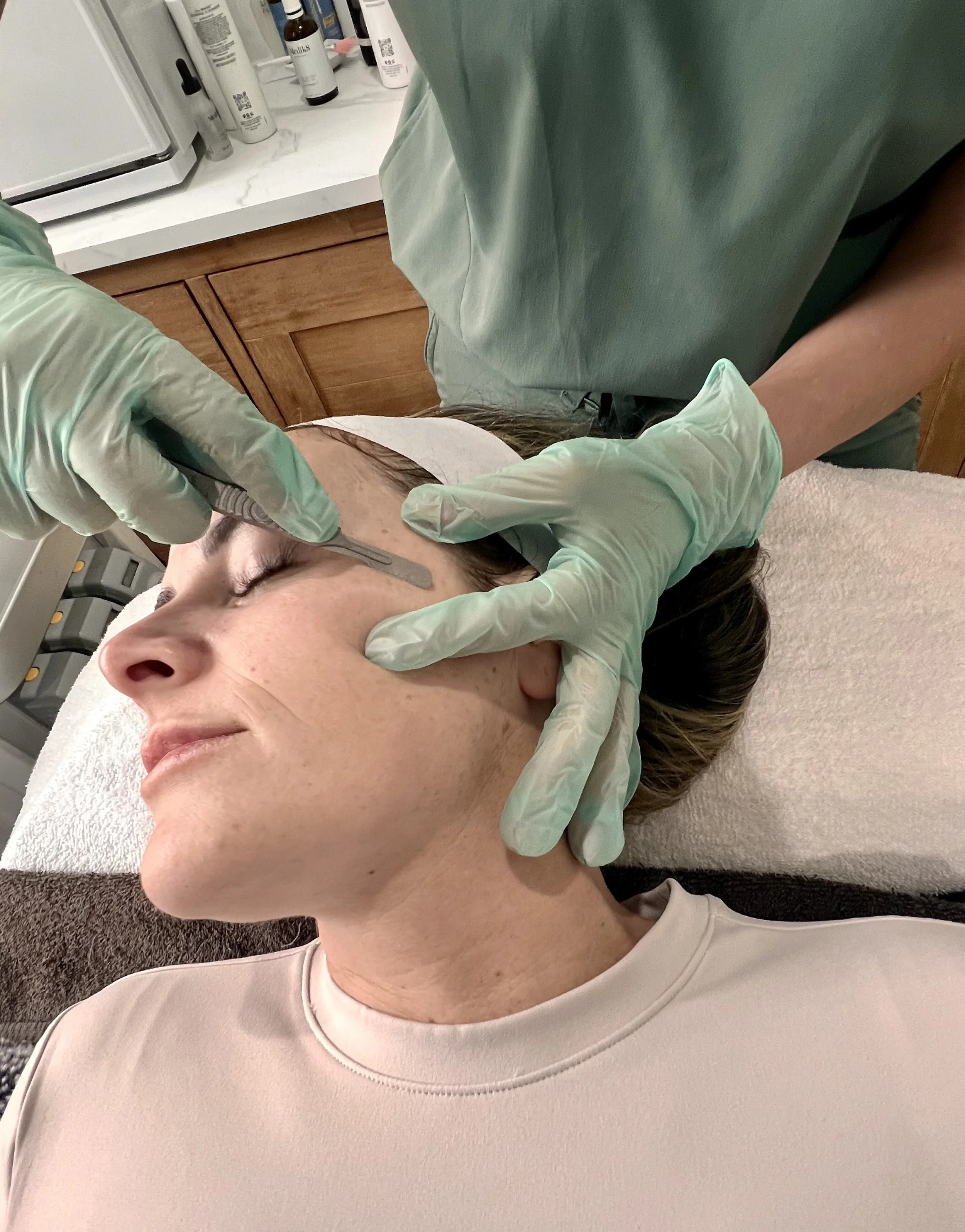 A woman with closed eyes lying on a treatment table while a medical professional wearing green gloves performs a procedure on her face with a small instrument. The setting appears to be a clinic or spa room with various bottles on a counter in the background.