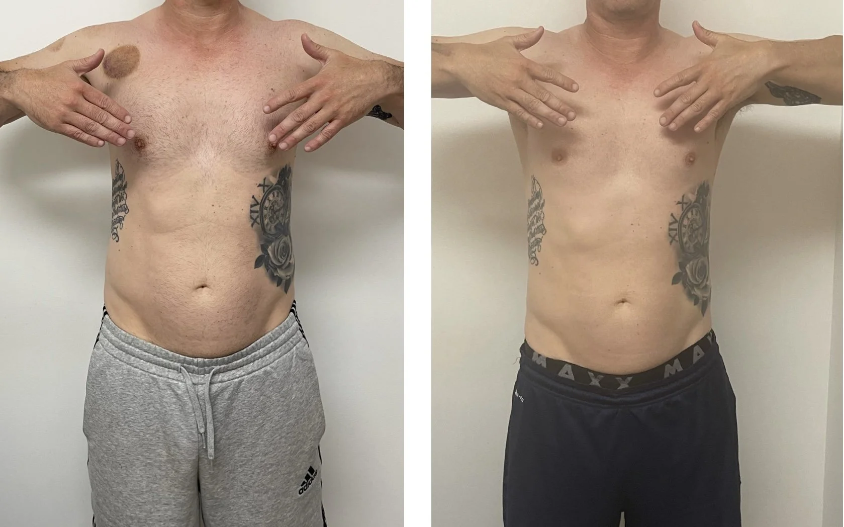 Comparison of a man’s upper body before and after weight loss or toning, showing visible change in physique, tattoos on the side, and different clothing.