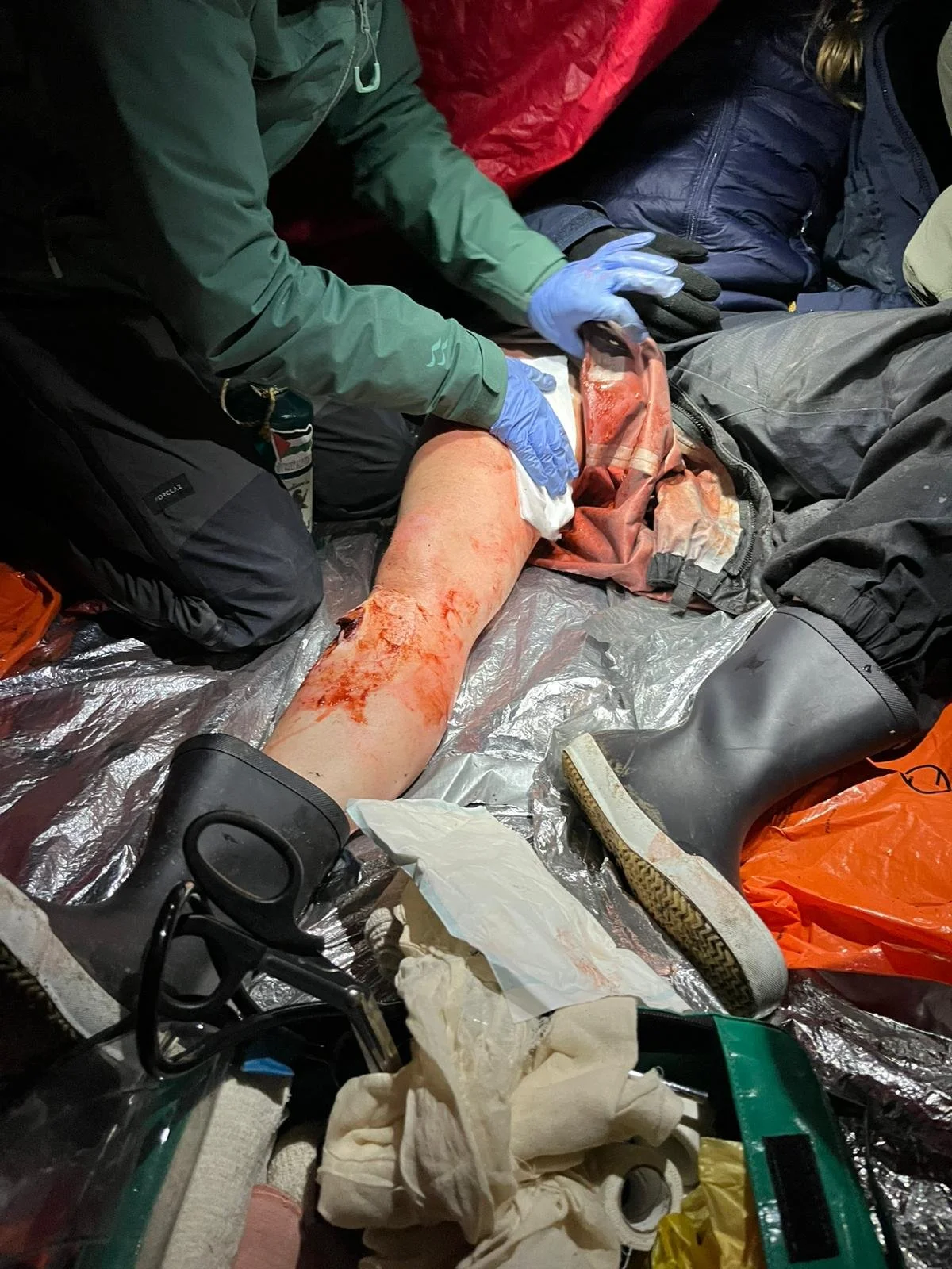 Medical personnel treating a severe leg injury on a person lying on the ground with visible blood and torn clothing, surrounded by outdoor gear and medical supplies.